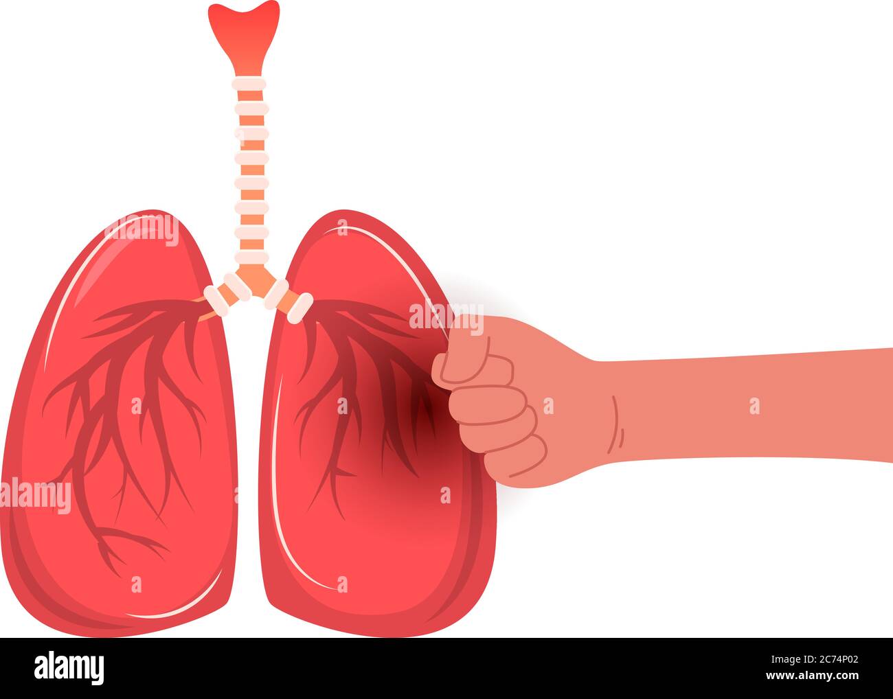 Dolore grave ai polmoni da una malattia. Il pugno umano batte il concetto facile di metafora. Illustrazione Vettoriale