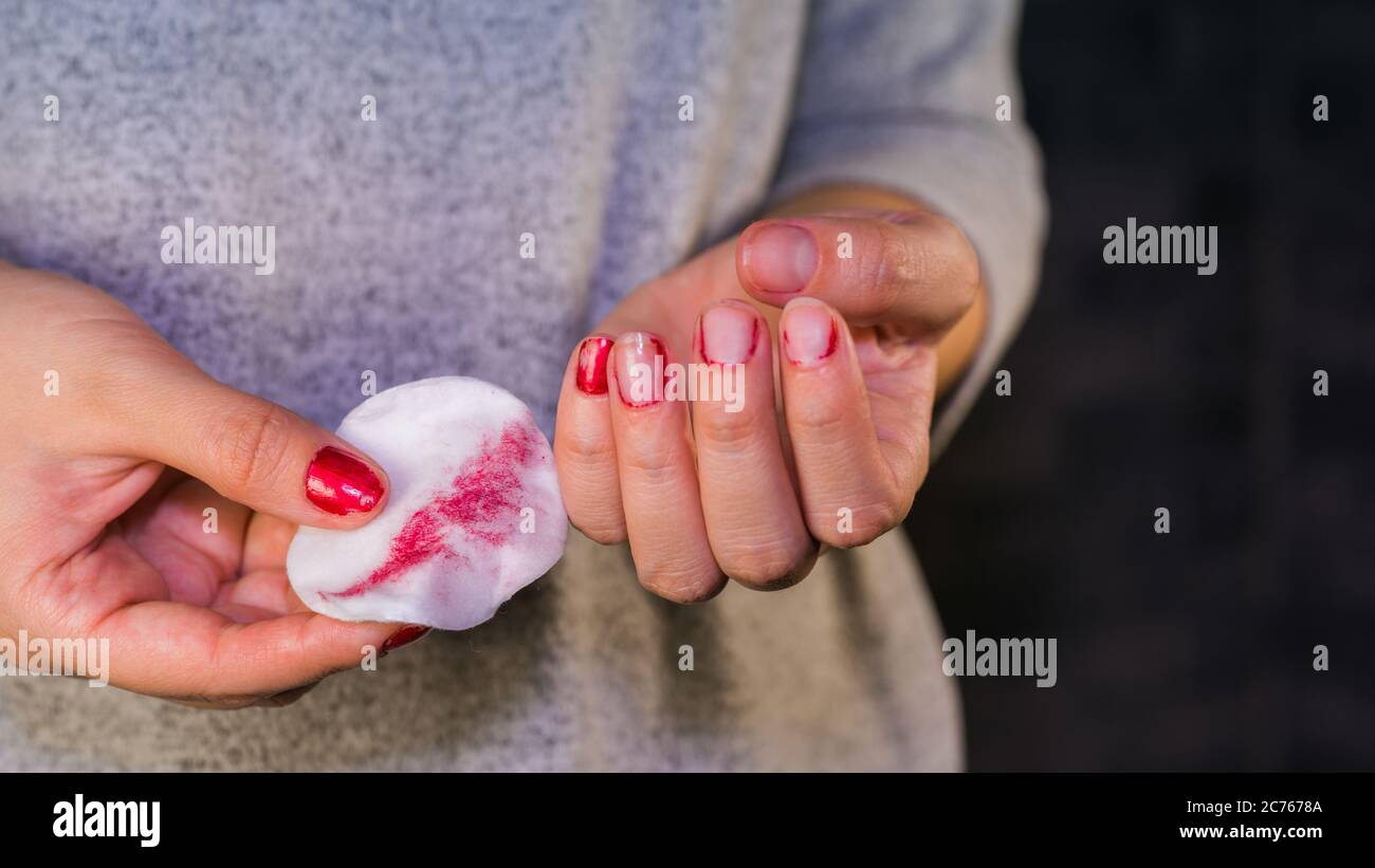 Donna rimuove lo smalto per unghie. Donna smalto rosso per unghie con tampone in cotone bianco. Foto Stock
