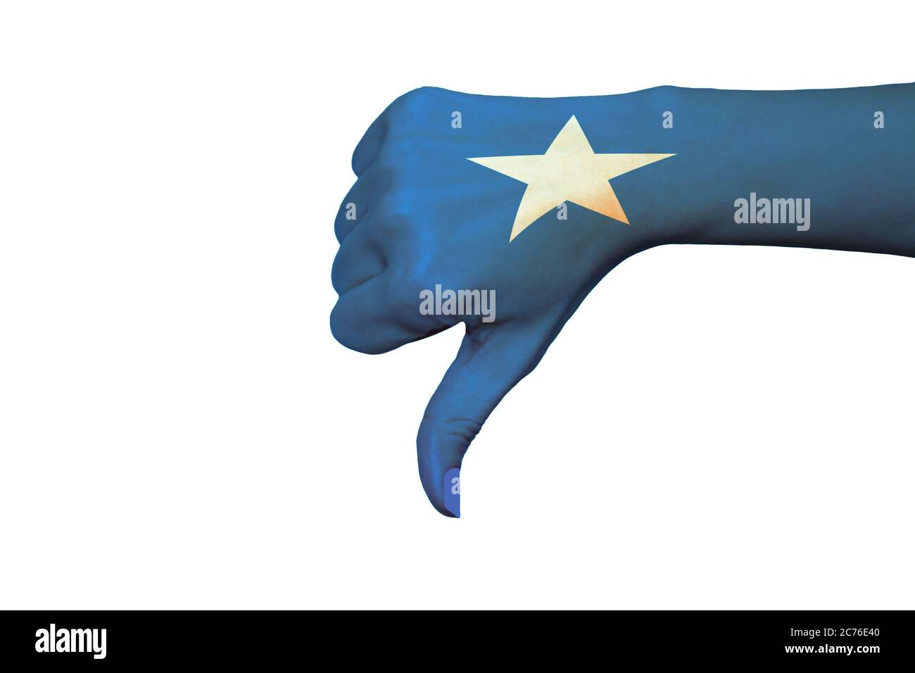 Bandiera Somalia con il pollice in giù su sfondo bianco isolato Foto Stock