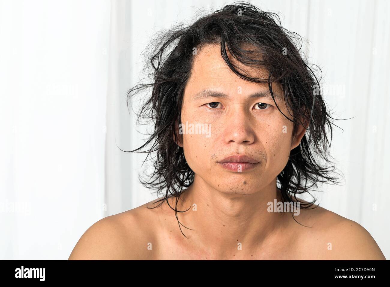 Primo piano facciale: Uomini asiatici di età 35-40 anni con la pelle problematica, cicatrici acne, rughe e macchie scure, mancanza di cura della pelle secca manca di umidità Foto Stock