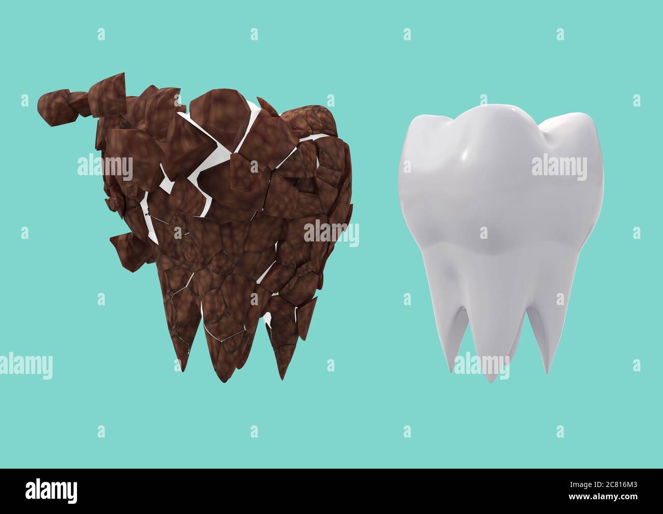 Molare marrone sporco e dente bianco pulito su sfondo blu. Concetto di pulizia della placca dei denti. illustrazione 3d Foto Stock