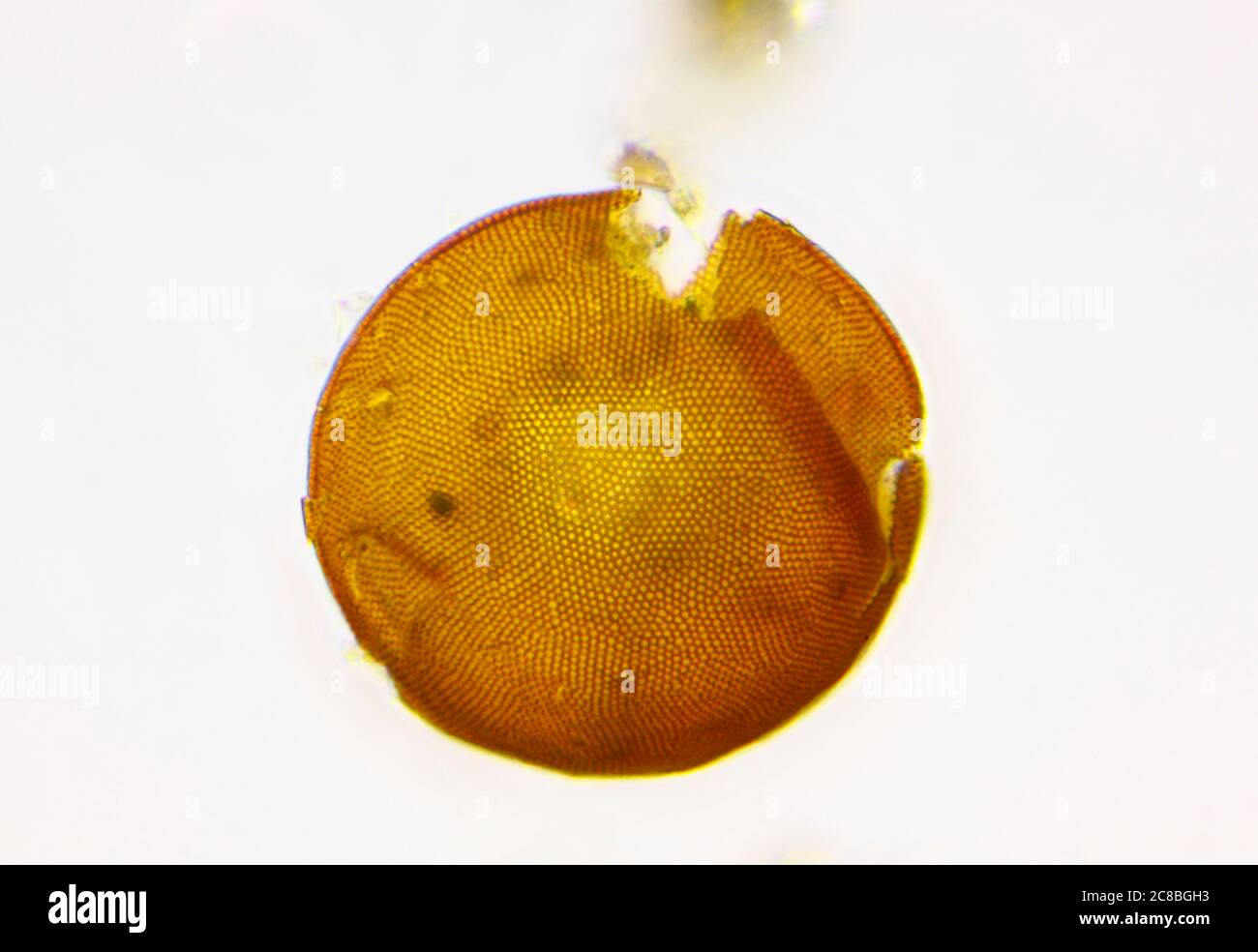Vista microscopica della conchiglia di ameba (Arcella) con schema di conchiglia chitinosa esterna visibile. Illuminazione a campo chiaro. Foto Stock