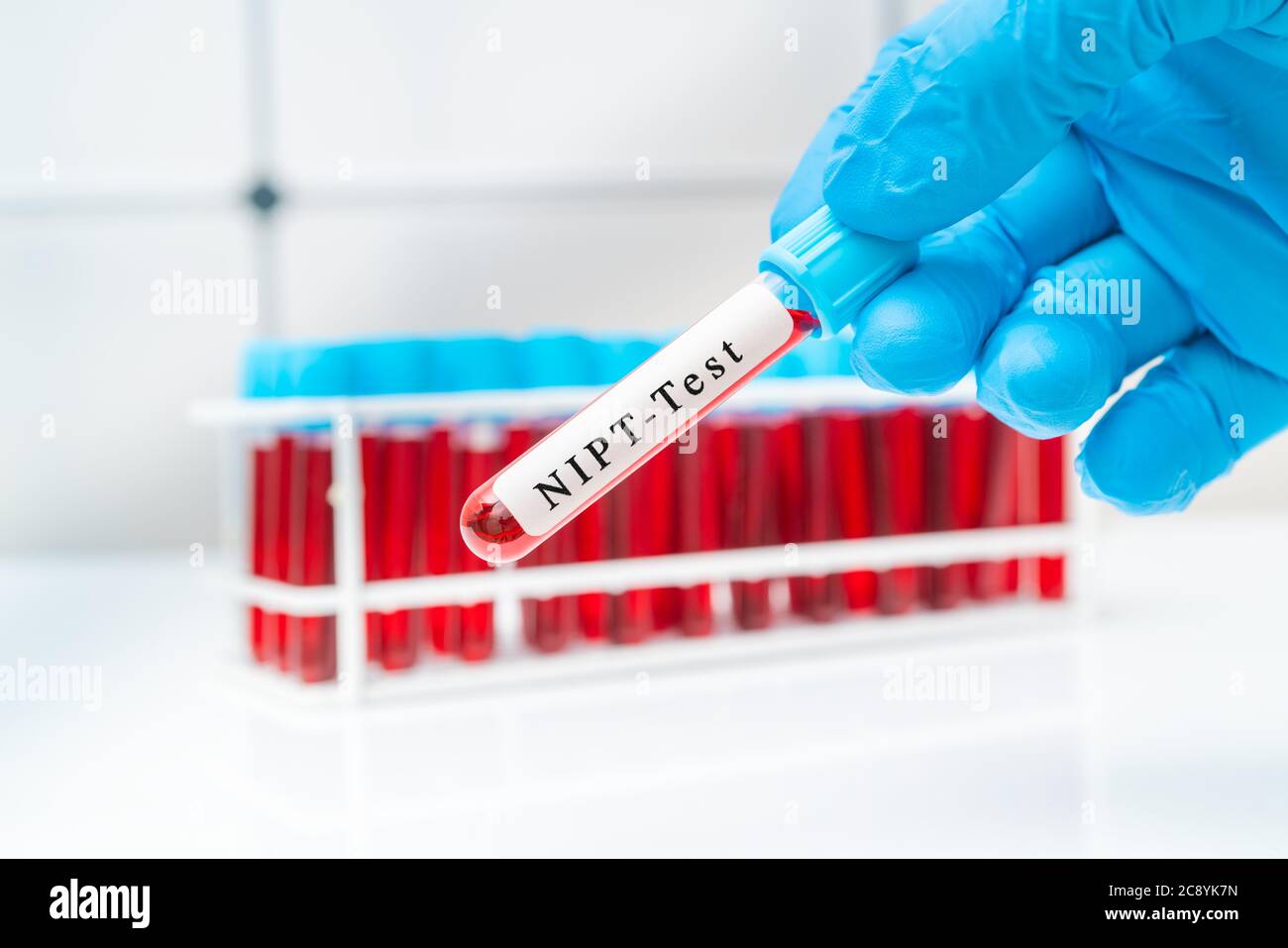 Provetta per il prelievo di campioni di sangue in mano medica per il test prenatale NIPT, diagnosi sindrome di Down in gravidanza donna Foto Stock