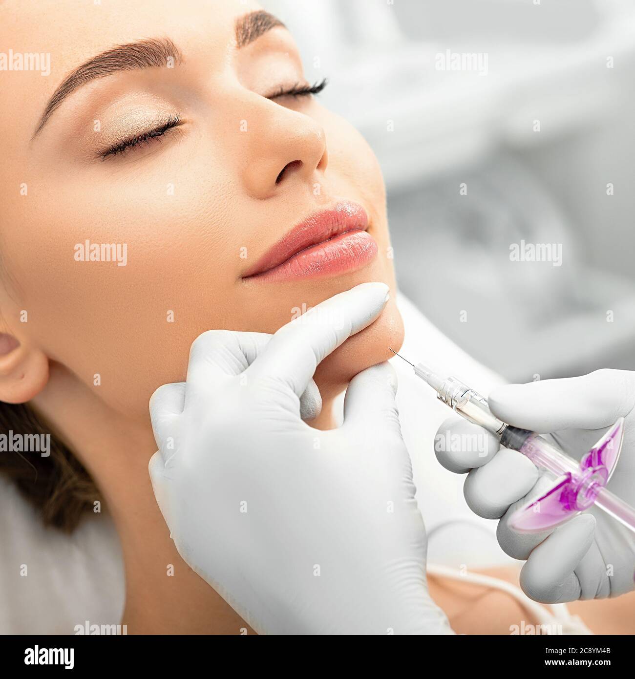 Donna durante la procedura di serraggio della pelle, iniezione di riempitivo dermico in una faccia femmina. La procedura anti-invecchiamento, ringiovanimento facciale Foto Stock