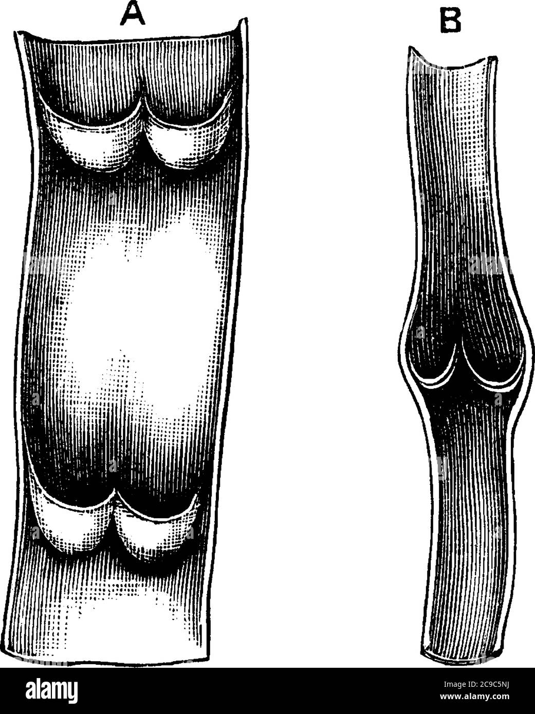La funzione della vena è quella di riportare il sangue deossigenato al cuore dopo che le arterie hanno eseguito il sangue. Qui è mostrata una parte di una vena aperta, con t Illustrazione Vettoriale