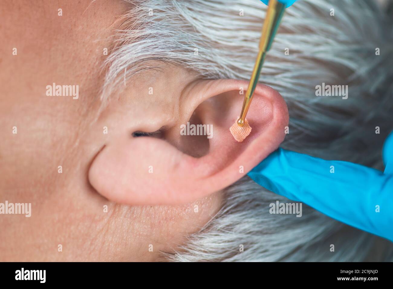 Auricoloterapia, o trattamento auricolare sull'orecchio umano con massaggio  flessibile penna auricolare in ottone, primo piano. Adesivo della pressione  di agopuntura sui semi dell'orecchio Foto stock - Alamy