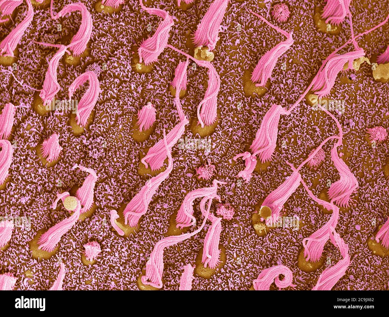 Cellule sensoriali dell'orecchio interno. Micrografia elettronica a scansione colorata (SEM) di fasci di ciglia (cellule pilifere, rosa) situati nei macula utriculi all'interno del Foto Stock