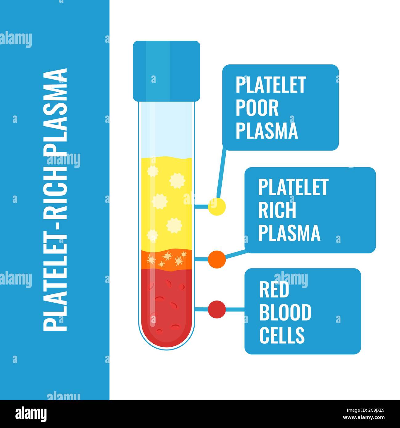 Composizione di plasma ricco di piastrine (PRP), illustrazione. Foto Stock
