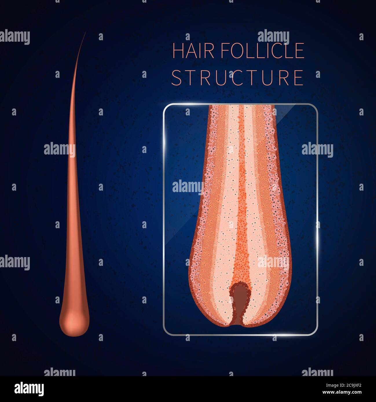 Follicolo per capelli, illustrazione. Foto Stock