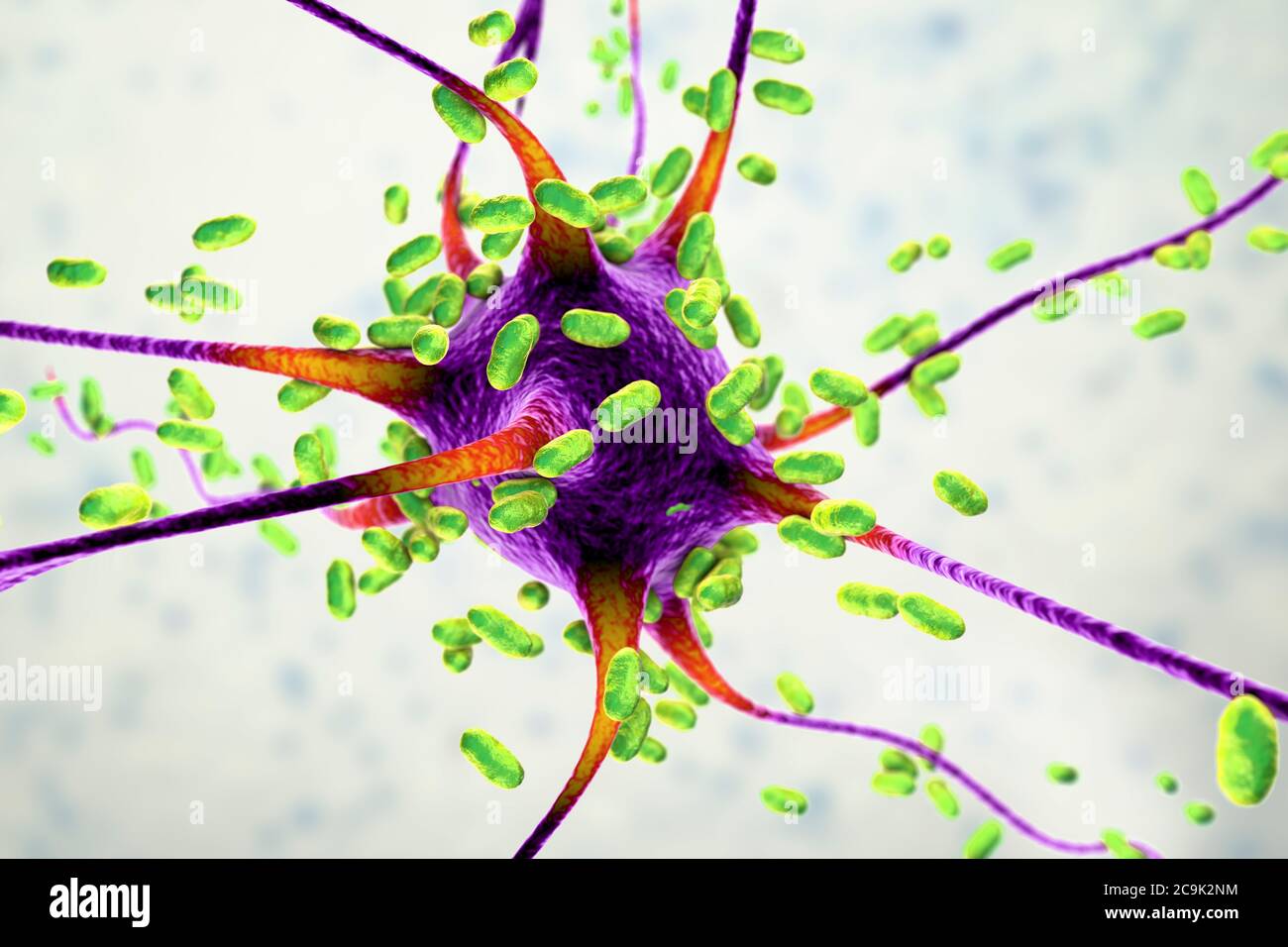 Encefalite batterica. Illustrazione concettuale del computer che mostra i batteri che infettano le cellule cerebrali. Foto Stock