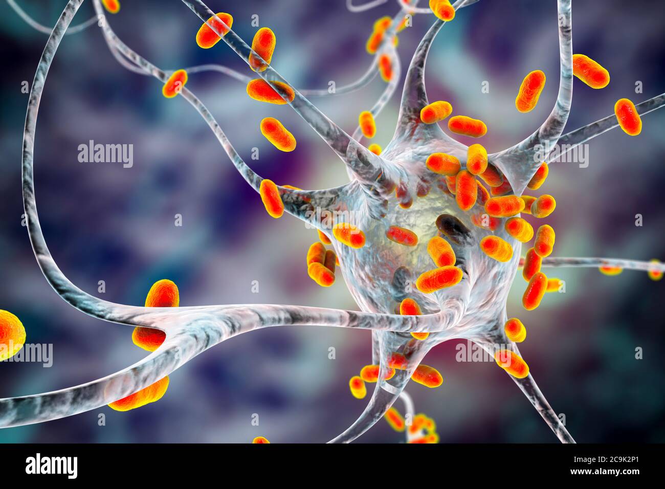 Encefalite batterica. Illustrazione concettuale del computer che mostra i batteri che infettano le cellule cerebrali. Foto Stock