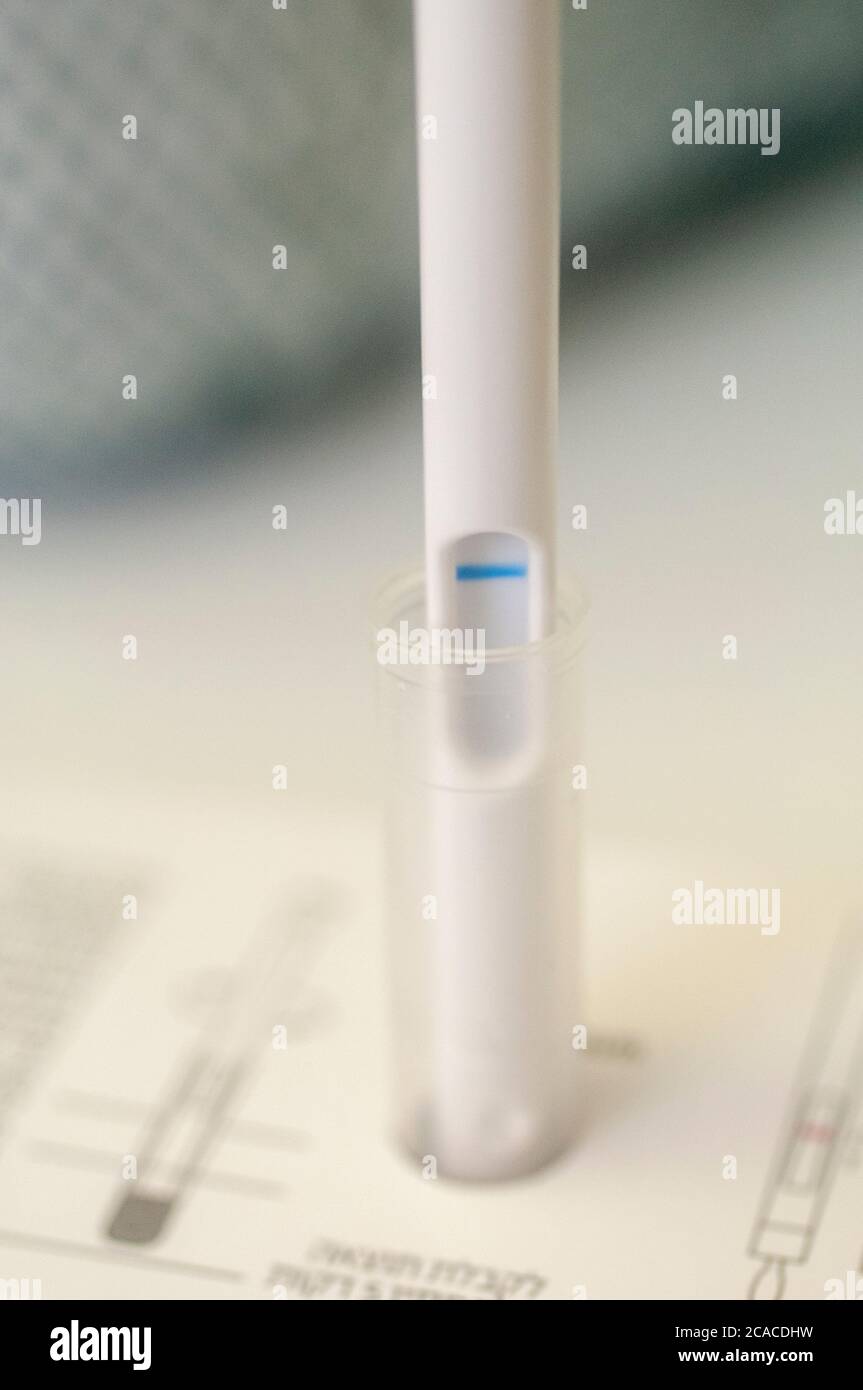 Diagnosi iniziale di streptococco A (streptococco A) con un tampone per gola Foto Stock