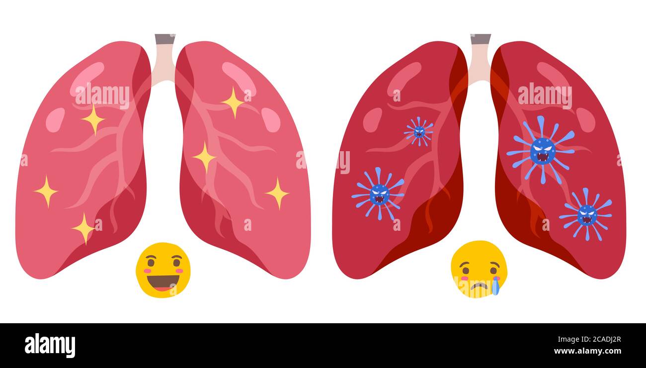 Polmoni sani e malattia polmoni vettore Illustrazione Illustrazione Vettoriale