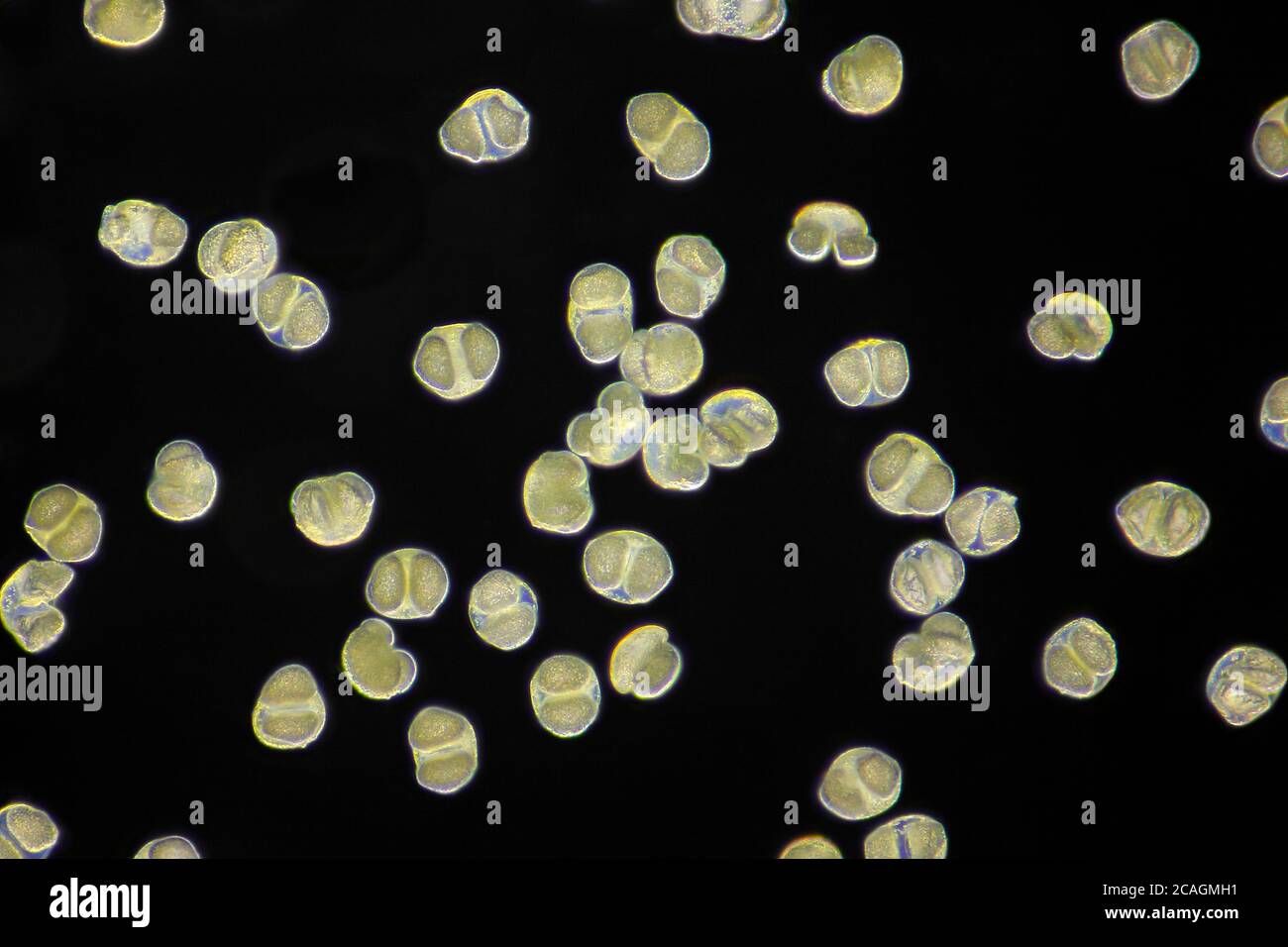 Vista microscopica dei grani di polline di pino scozzese (Pinus sylvestris). Illuminazione a campo scuro. Foto Stock