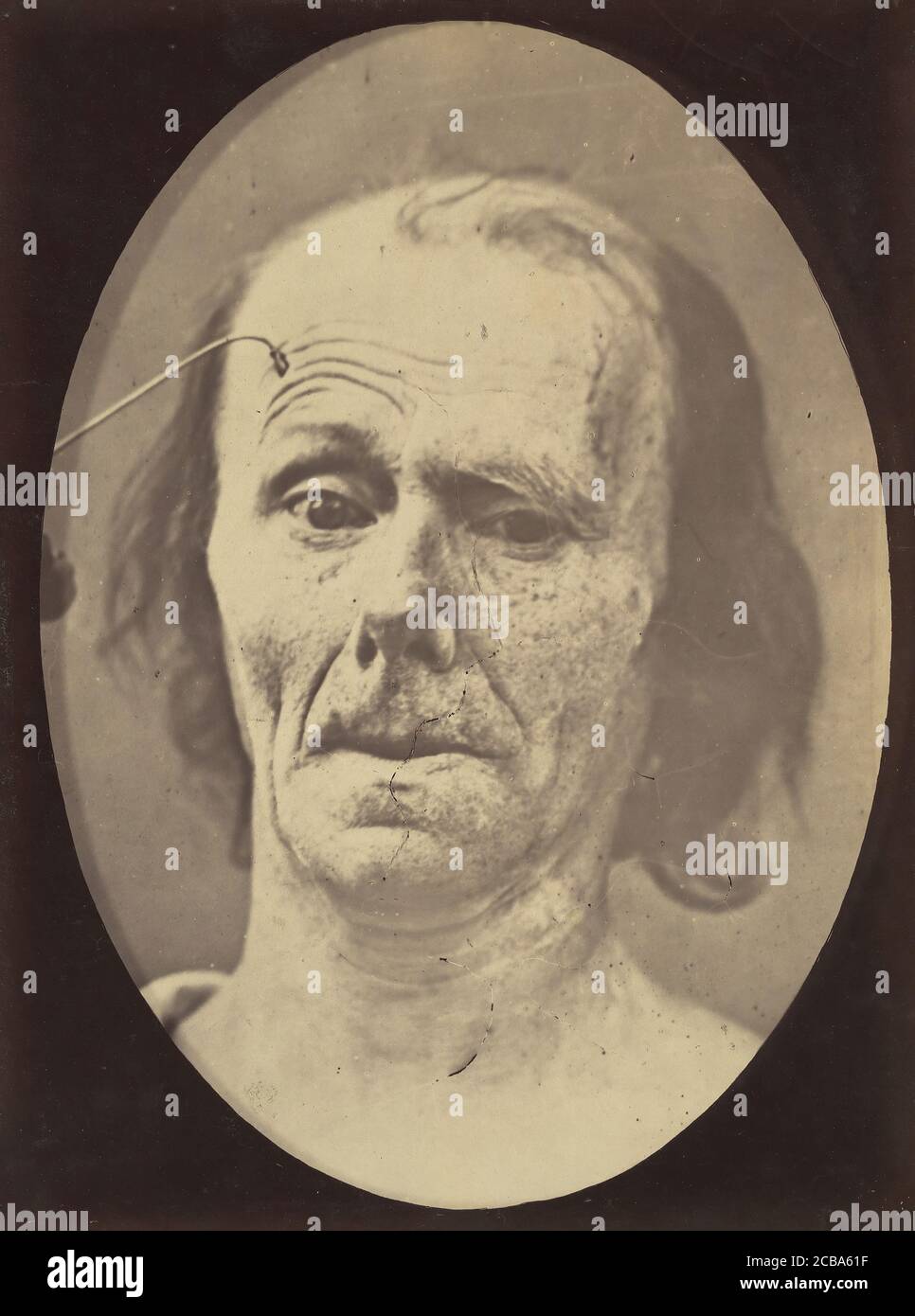 Figura 9: Uno studio di m. frontalis in massima contrazione, 1854-56, stampato 1862. Foto Stock