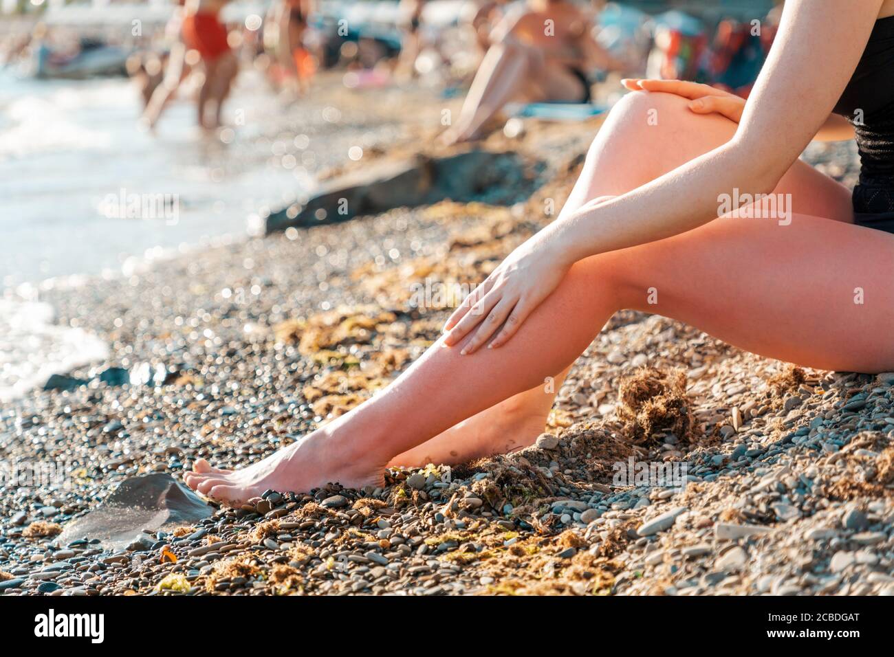 Una donna in costume da bagno si siede sulla spiaggia e mostra una scottatura sulle gambe con la mano. Primo piano delle gambe. Concetto di pelle. Foto Stock