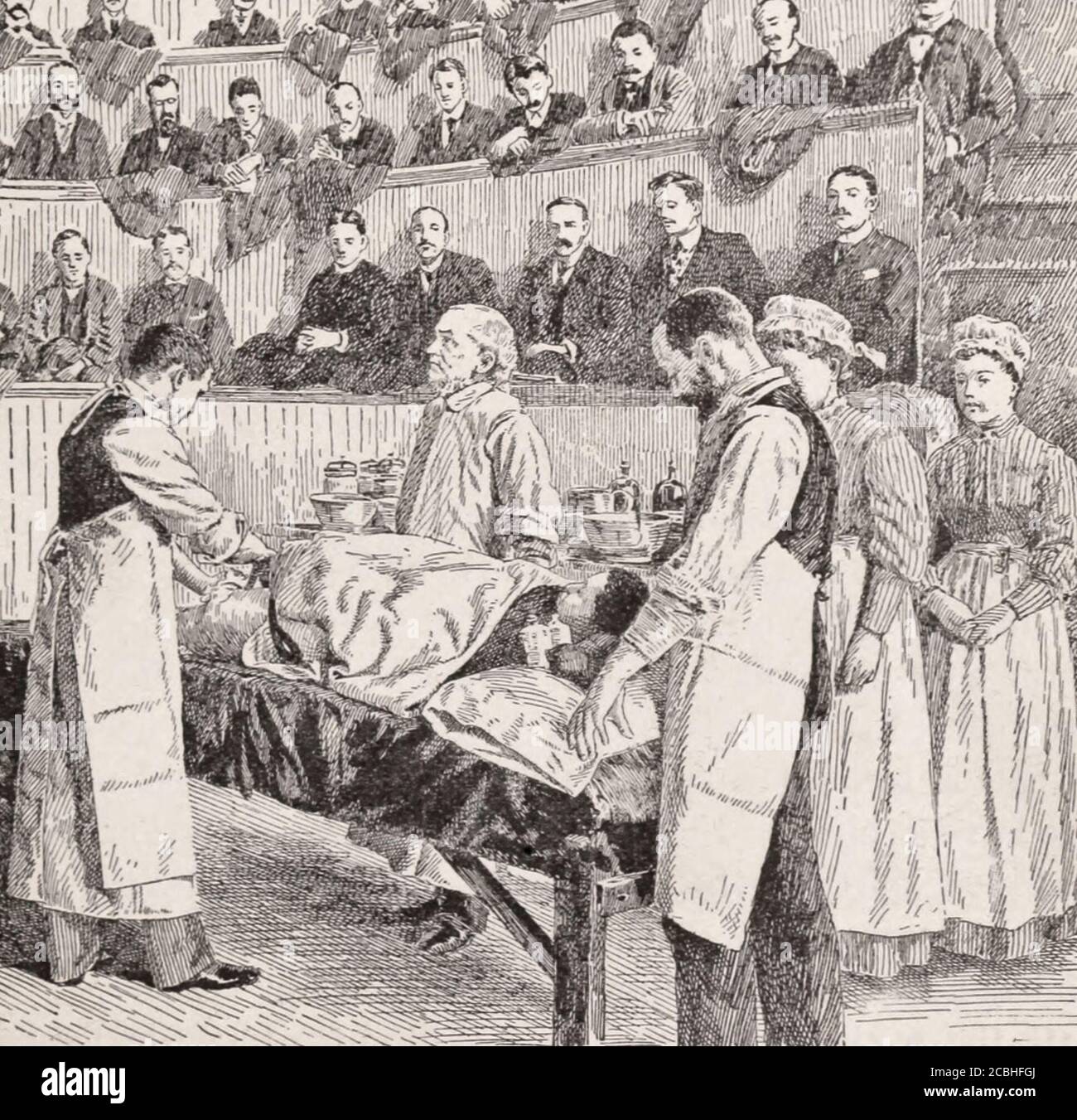 Un'operazione chirurgica nell'Ampitheater al Bellevue Hospital, New York City, circa 1892 Foto Stock