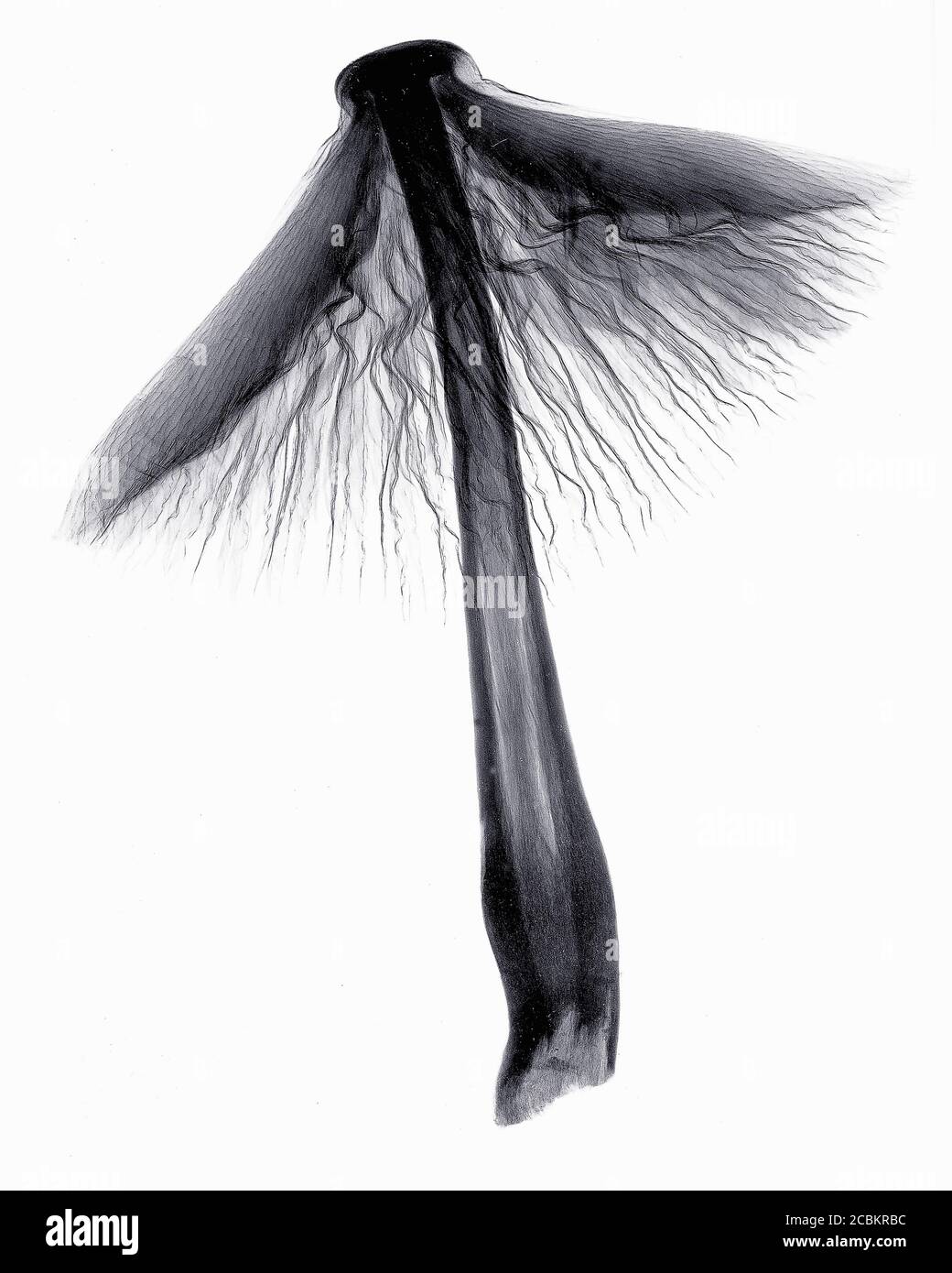 Immagine radiografica del fungo Foto Stock