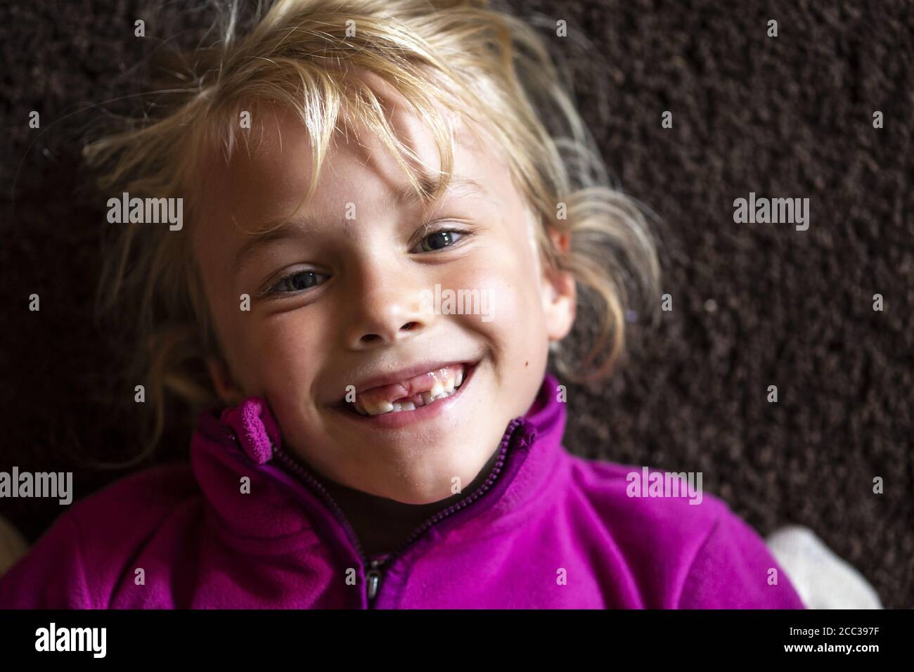 Ragazza (8) con traferro dentato, Kiel, Schleswig-Holstein, Germania Foto Stock