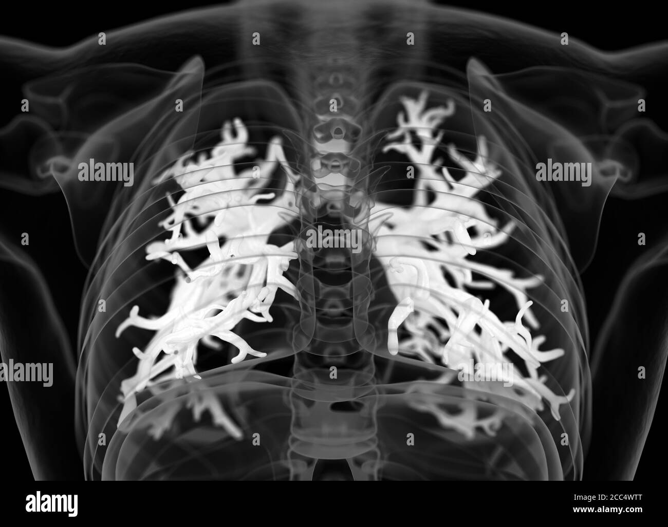 Illustrazione anatomica di bronchi umani e trachea. illustrazione 3d Foto Stock