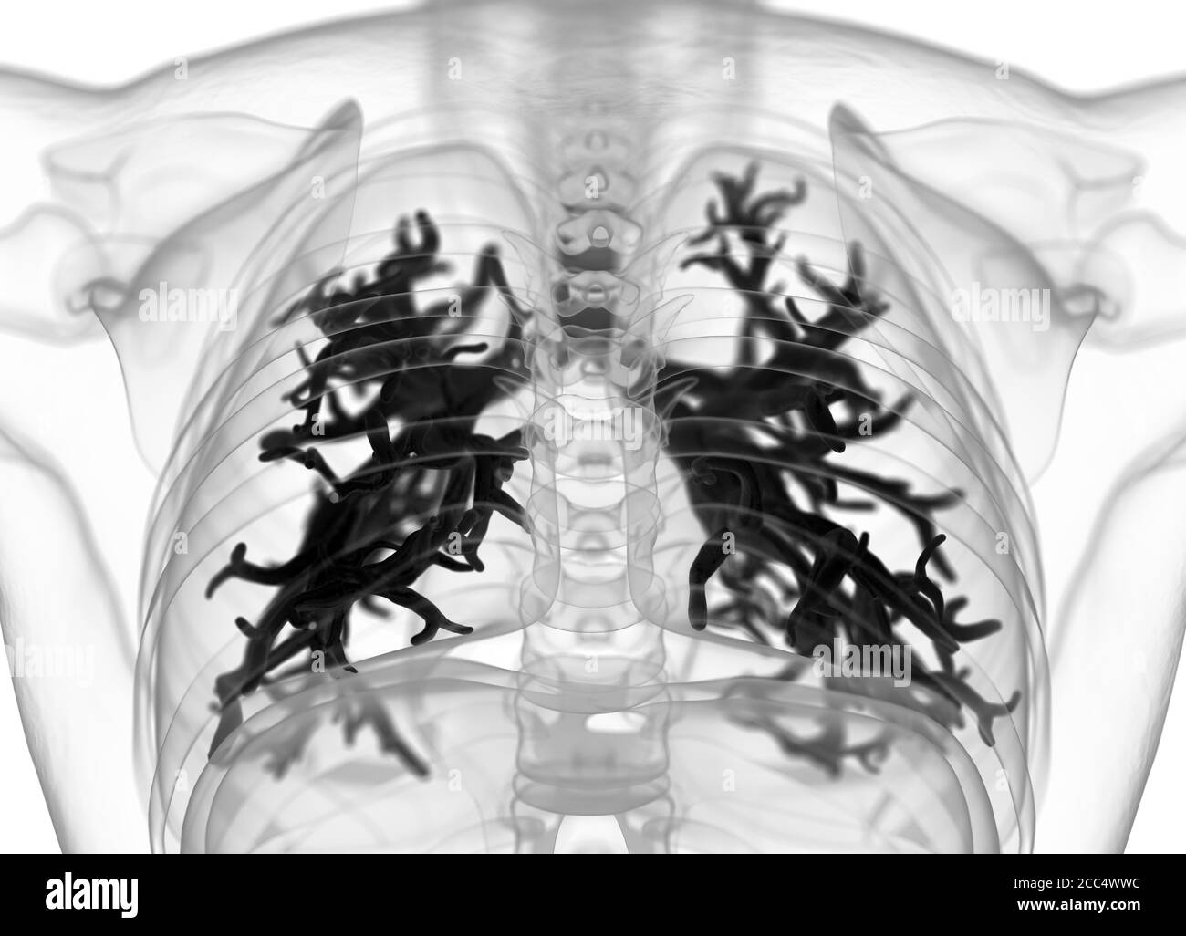 Illustrazione anatomica di bronchi umani e trachea. illustrazione 3d Foto Stock