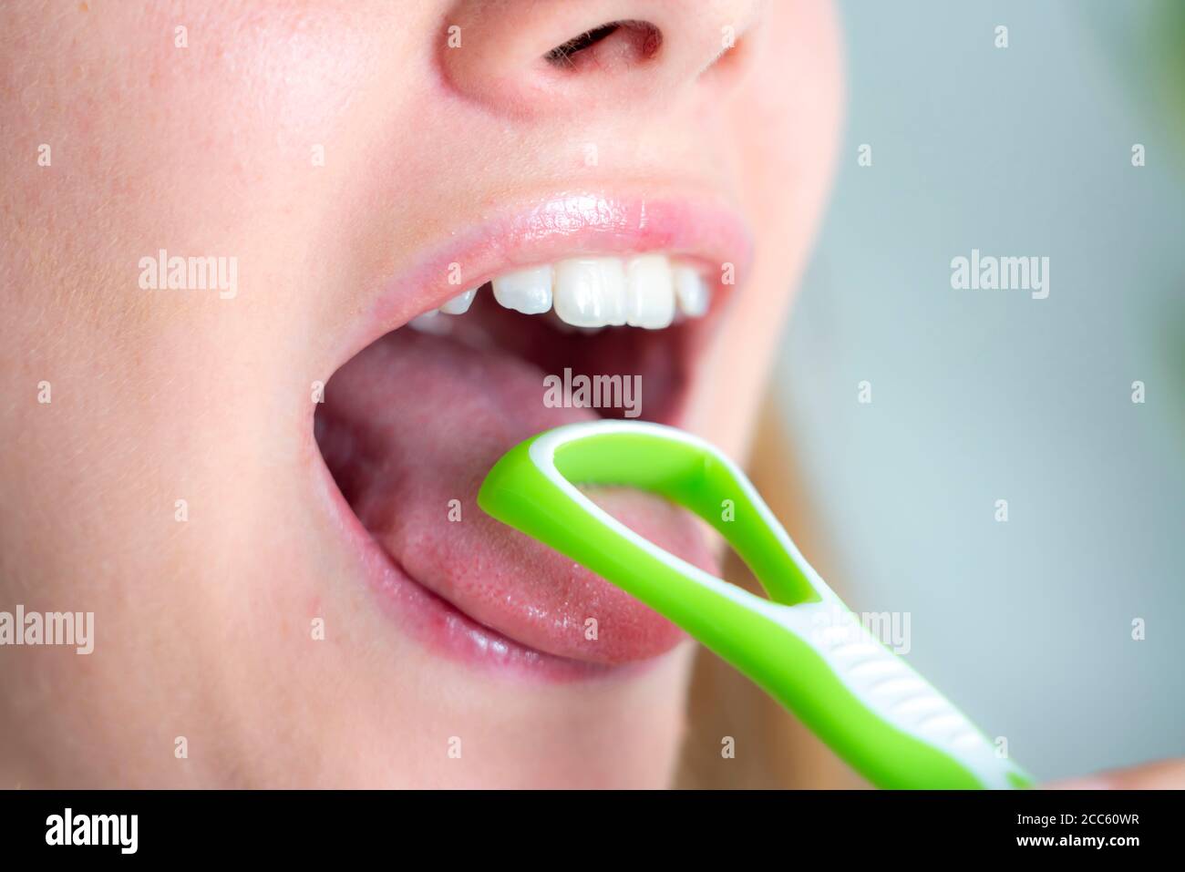 Alito cattivo, prevenzione pulendo la lingua con una spazzola lingua Foto Stock