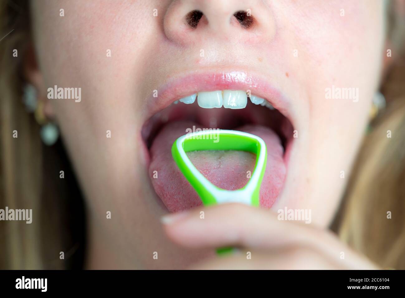 Alito cattivo, prevenzione pulendo la lingua con una spazzola lingua Foto Stock