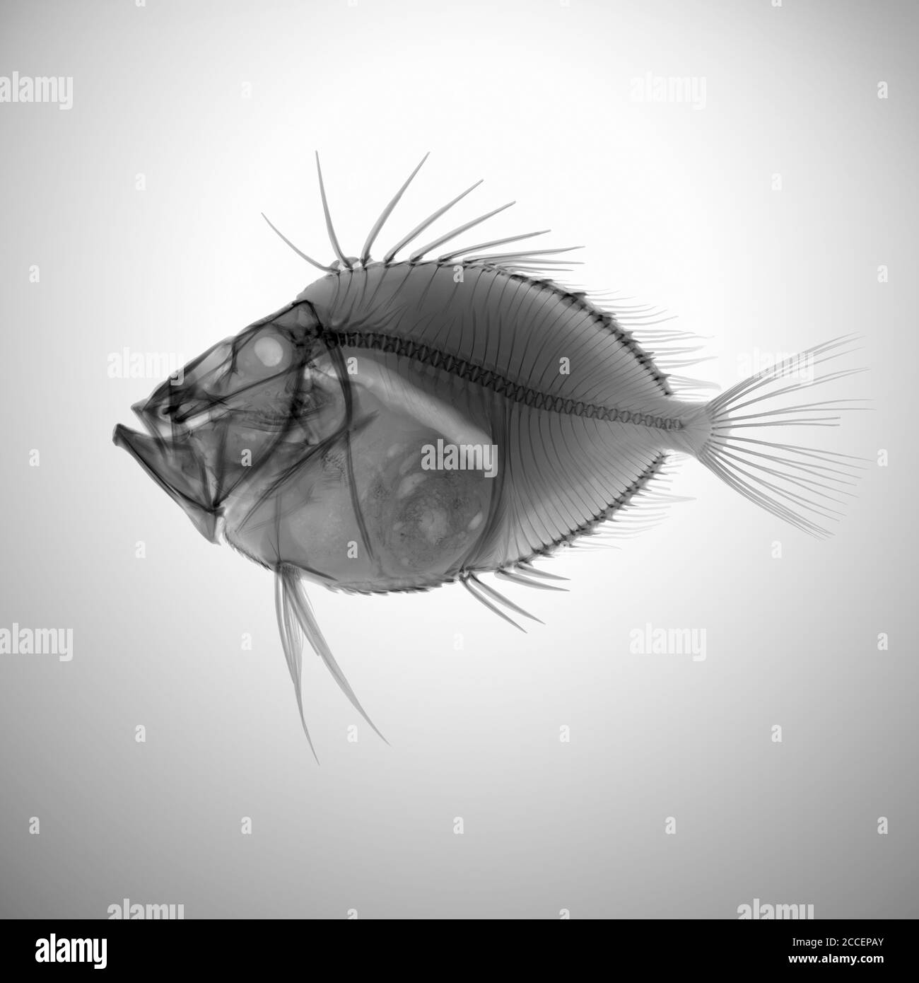 Pesce John Dory, raggi X. Foto Stock