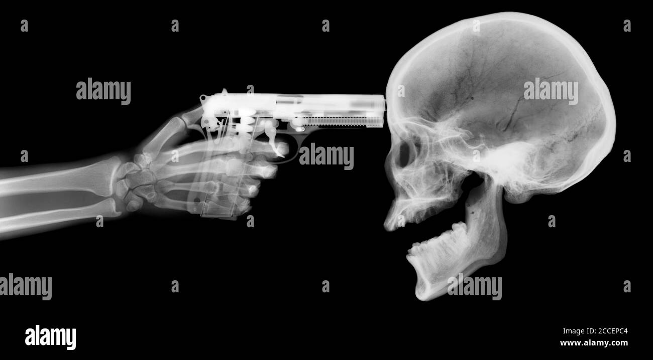 Pistola e scheletro, raggi X. Foto Stock