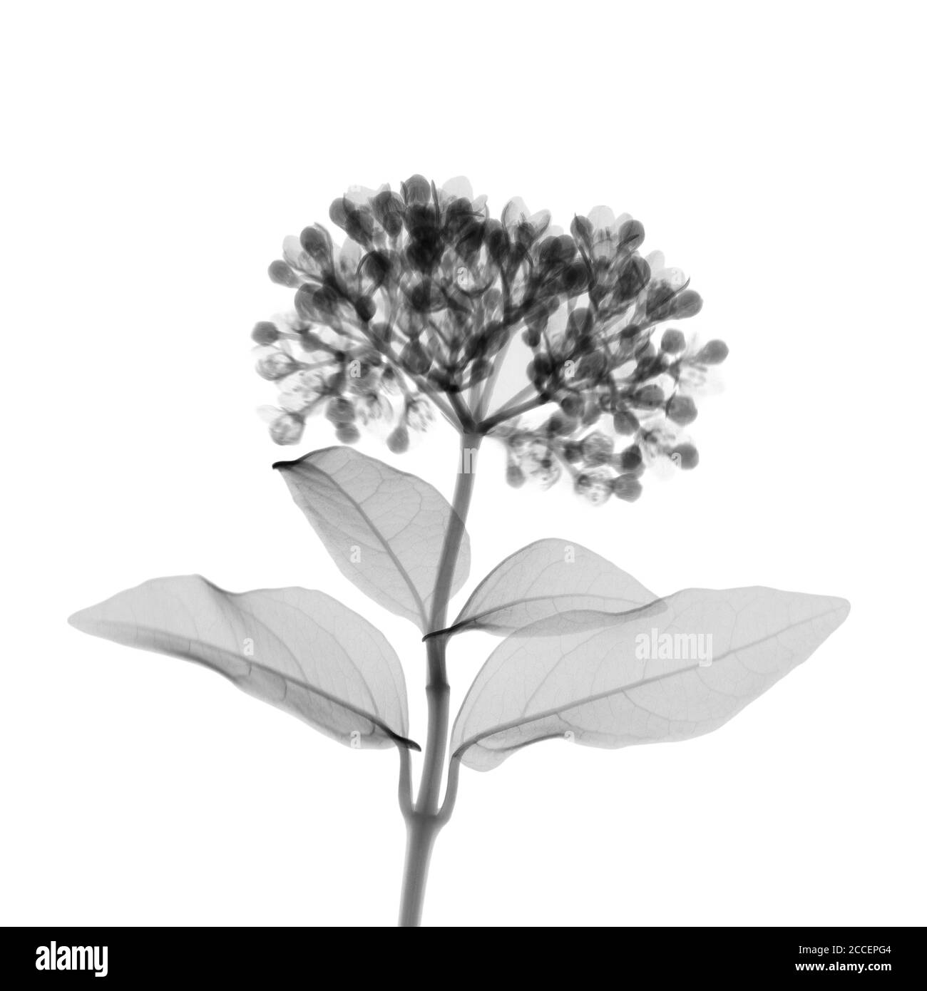 Sambuco, raggi X. Foto Stock