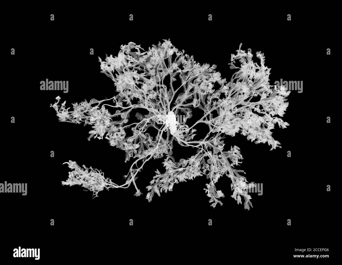 Alghe arroccate (Fucus vesiculosus), raggi X. Foto Stock