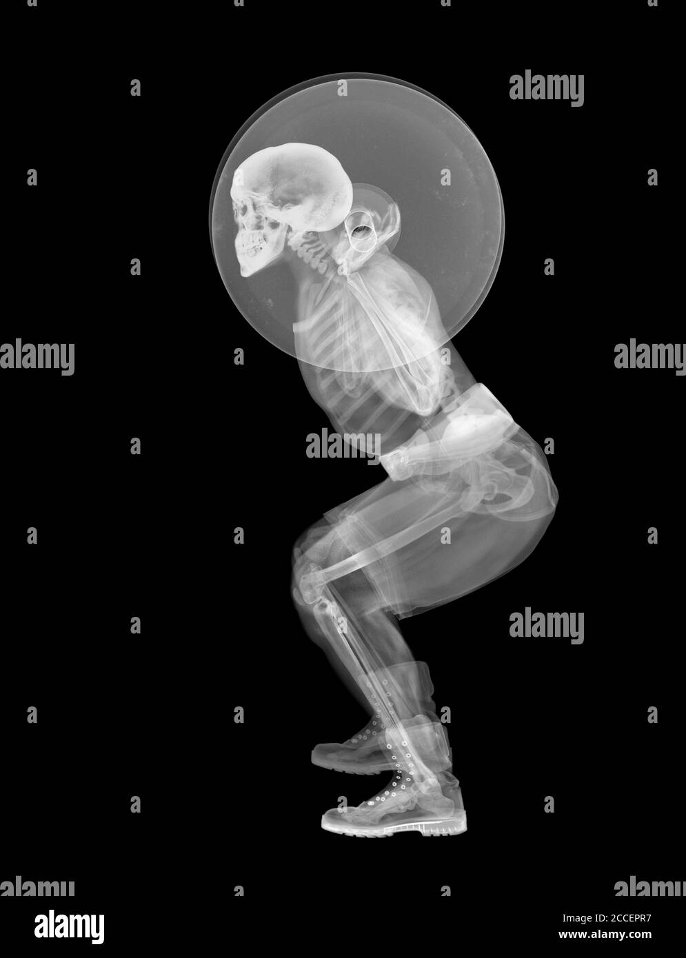 Sollevamento pesi scheletrici, raggi X. Foto Stock