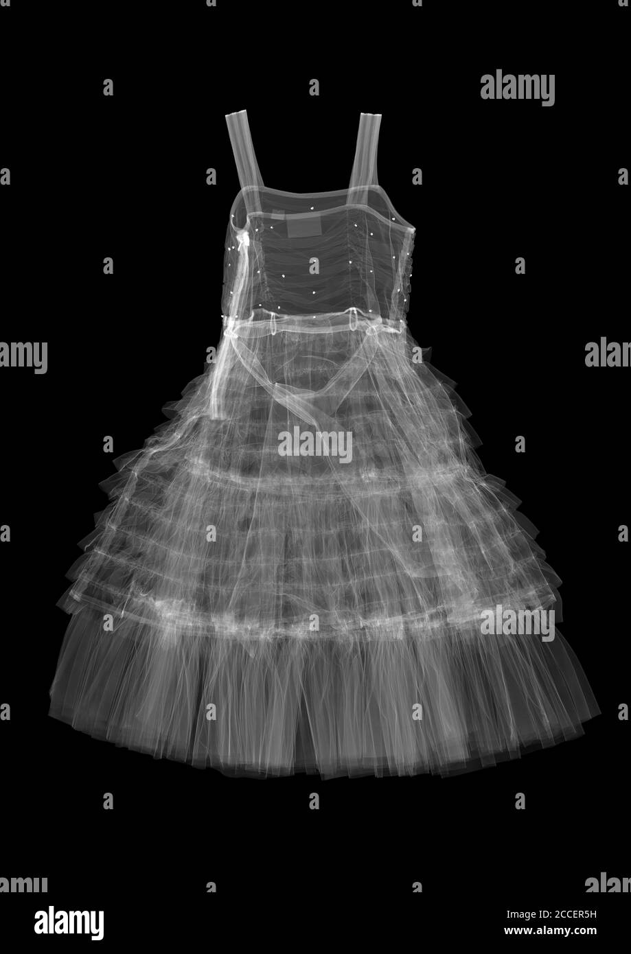 Abito per bambini, raggi X. Foto Stock