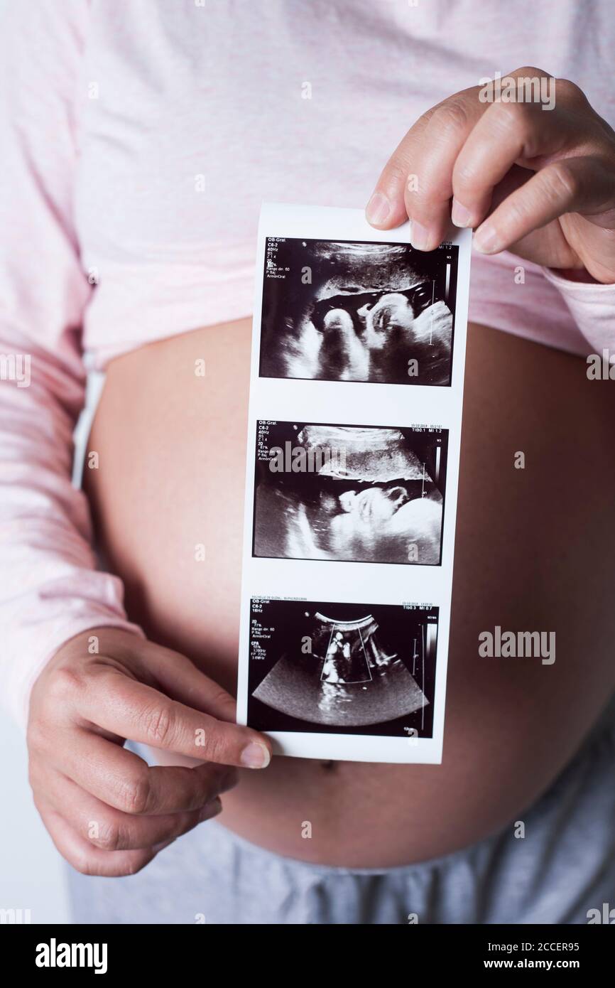 Donna incinta che tiene le scansioni del bambino Foto Stock