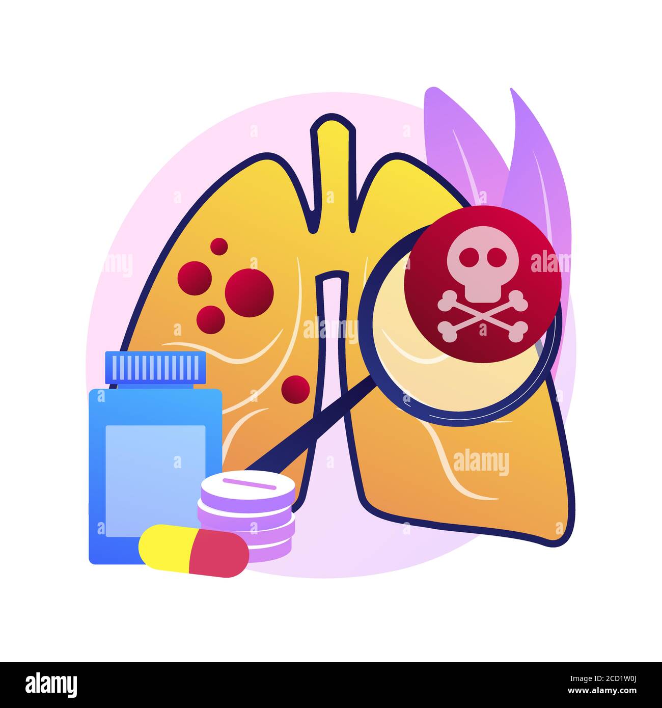 Illustrazione vettoriale astratta delle infezioni respiratorie inferiori. Illustrazione Vettoriale