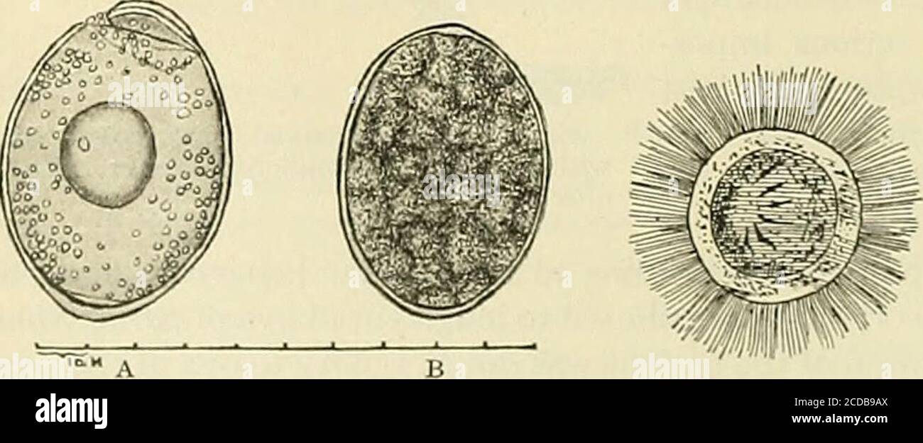 . La pratica della medicina; un testo-libro per i professionisti e gli studenti, con particolare riferimento alla diagnosi e al trattamento . Fig. 41. - Dibo-Ihriocephalus latis (Leuckart.). Fig. 42.-ova. ol dibolhrioccphaUis latiis: FIC. 43. - libera A, dopo trattamento con acido solforico in modo da nuoto embryo ofas per rendere il coperchio evidente; B, naturale appear- dibolliirioccplialtis la-ance in materia fecale. Liis. Xsoo. {Leuck- art.) Foto Stock