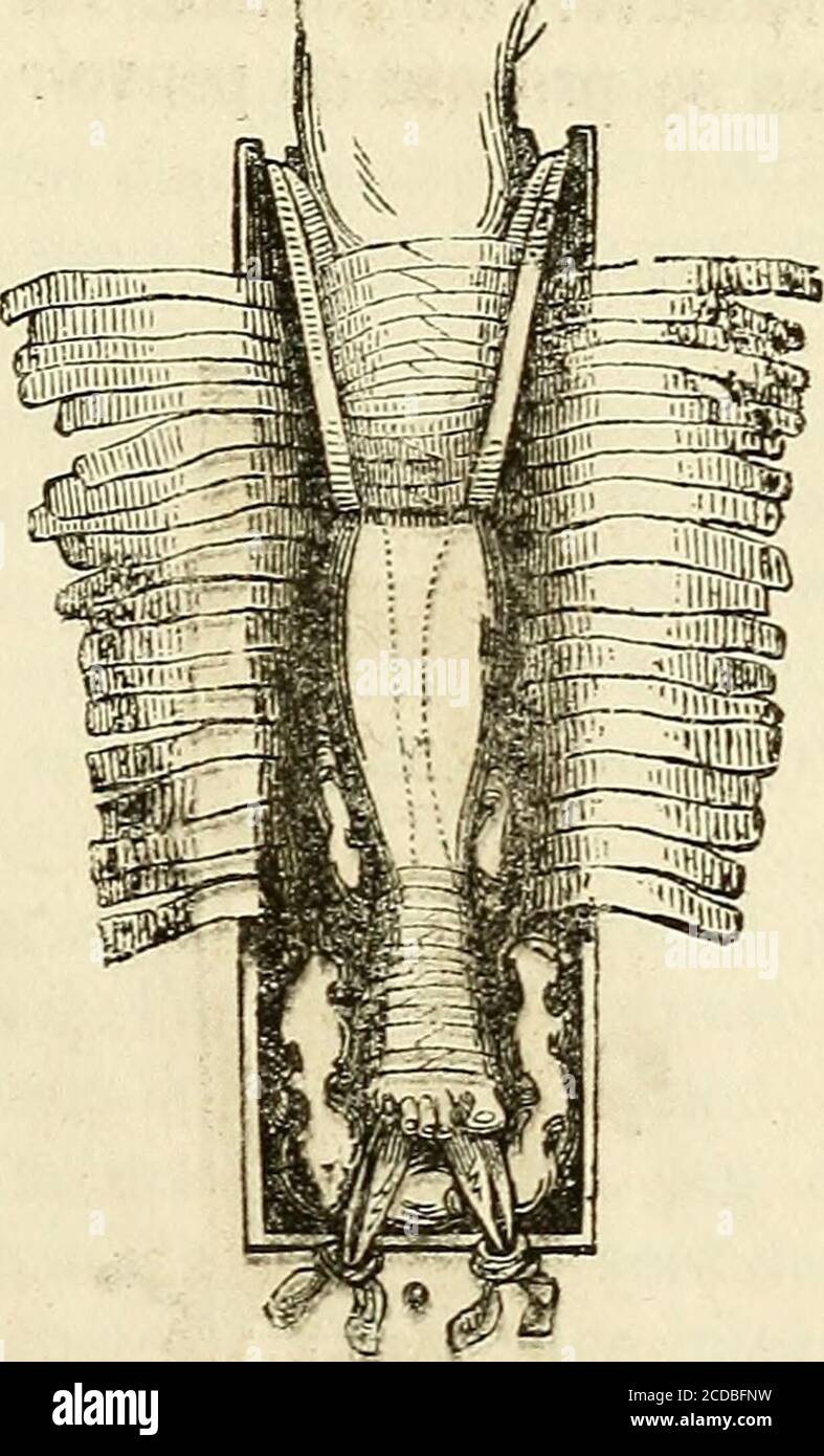 . Manuel de Petite chirurgie . e-extensifssur le genou. Elle se fait de la même manière que pour le pied,cegt-à-diré quil faut avoir le soin denvelopper le genou dune APPAREILS A EXTENSION DE M. BACDENS. 265 couche épaisse de coton et dun bendage solidifié par un vernisde gomme. Les lacs de toile, qui sont assez longs pour arriver àlextrémité digitale, où ils seront Plus tard attachés, sont fixéspar de nouveaux tours de spire à leur partie moyenne. Lextré-mité inférieure de chaque lacs est renversée, et est égalementfixée jusquau-dessus du genou par quelques tours de bande. 11faut avoir soin d Foto Stock