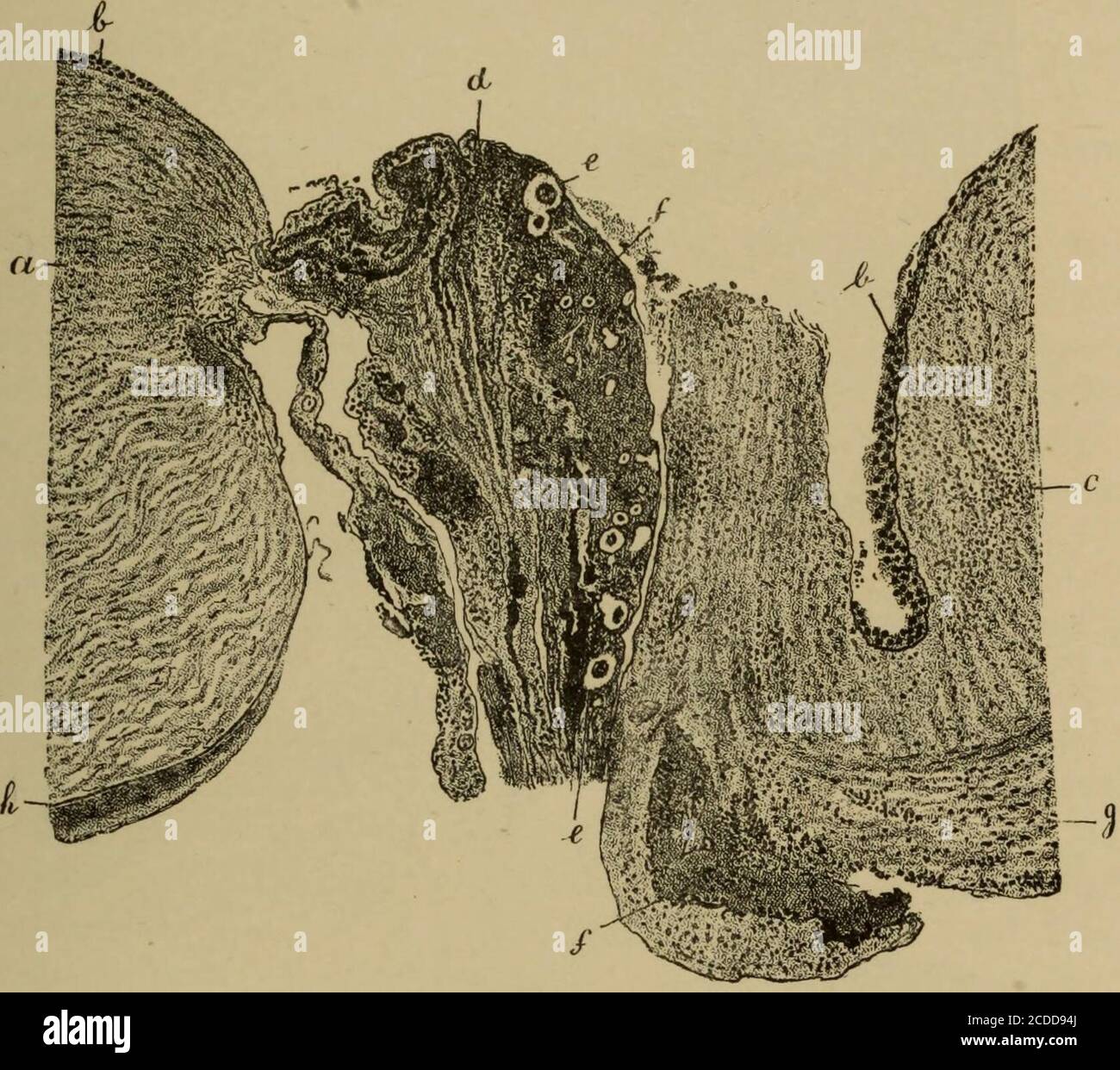 . Gli elementi di istologia patologica con particolare riferimento ai metodi pratici. Le cellule corneali. Nella cicatrizzazione delle ulcere più grandi si ha anche in tutti i casi una nuova formazione dei vasi sanguigni (Fig. 207, &), che corrono all'ulcera dal limbus congiuntivale. Possono di nuovo scomparire nel corso del processo subse-quent, ma pigmento marrone granulare è spesso lasciato dietro nella cicatrice. Si verifica anche una nuova formazione di vasi sanguigni, tuttavia, la cheratite diventa più cronica o si ripresenta frequentemente. Il corneamay poi eventualmente si permea con i vasi nella sua estensione di interezza, il c Foto Stock