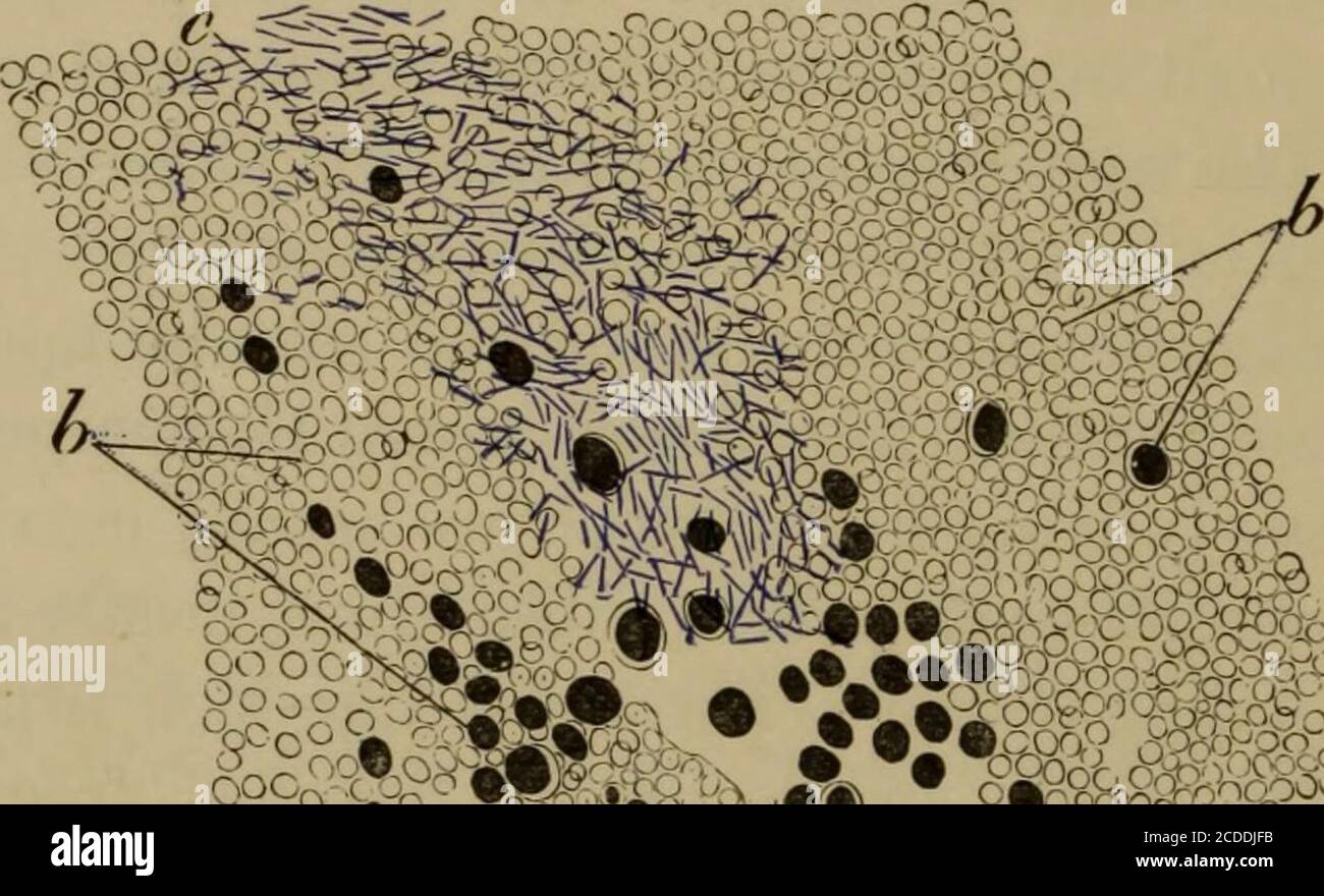 . Gli elementi di istologia patologica con particolare riferimento ai
