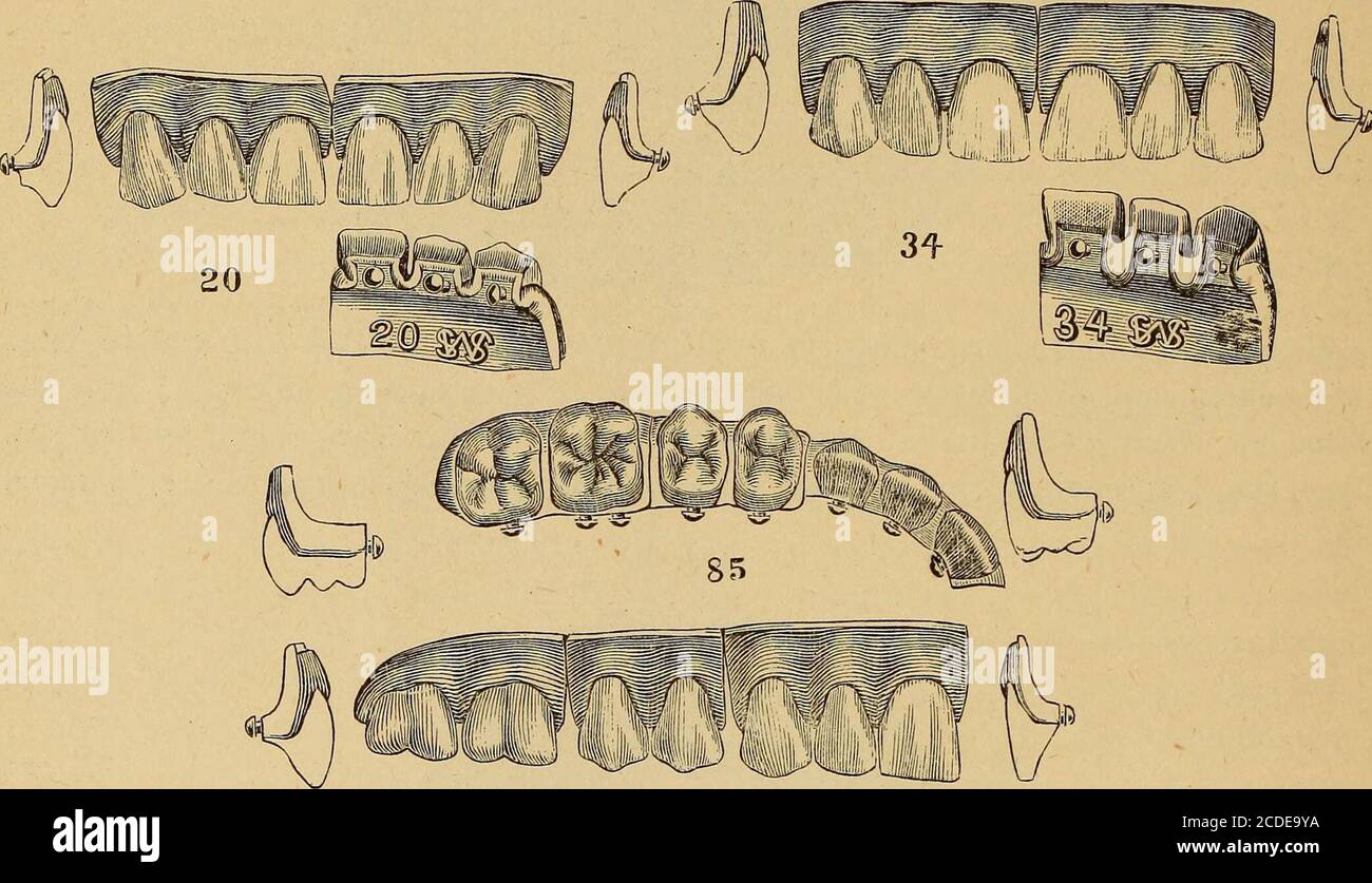 . Catalogo di materiali dentali, mobili, strumenti, ecc., in vendita; particolari sono suggeriti all'osservatore acuto da certe caratteristiche degli organi dentali. L'artista che cerca di ristabilire l'armonia nell'espressione facciale dovrebbe besillare nell'osservanza di queste varie manifestazioni; tale abilità è richiesta sia nella fabbricazione che nell'applicazione di dentini artificiali. 22 bianchi S. S. oltre a queste qualità estetiche, i denti in porcellana devono possedere (3) Strengtheadjed all'uso legittimo per cui sono destinati; questa forza deve comedalla qualità Foto Stock