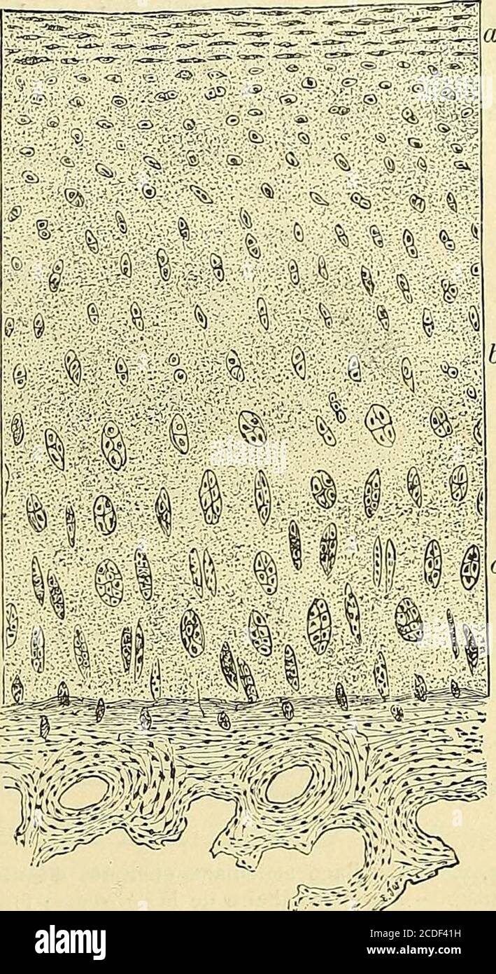 . Traité de la goutte . eutse faire des érosions qui mettentlos à nu. Ainsi que je lai déjà dit, il ny apas de revêtement synovial à la surface libre du cartilage. La zone superficielle est environnée decellules fusiformes, enfouie dans une substance fondamentale quiprésente également des caractères diffrents de ceux quon voit dansdautres parties du a. Ainsi elle prend un aspect fiberux et eststriée horizontalement sur environ un sixième de profondeur ducartilage. Laspect fiberux est quelquefois très net sur des coupés où lesfibers sont en partie détachées de la surface libre en leces com Foto Stock