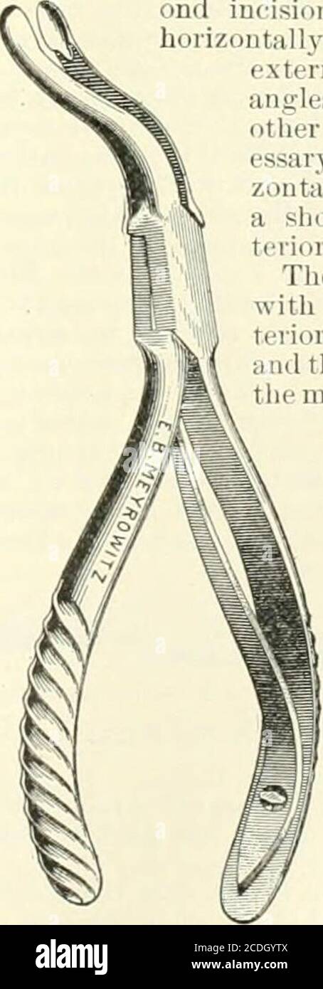 . Un manuale di riferimento delle scienze mediche che abbraccia l'intera gamma della medicina scientifica e pratica e delle scienze alleate. :j:j23.-Baoons Rongeur Forceps.. Fig. 3.334. - Jansens Forcepsfor Removing Posterior CanalWall. Ttl3 j?la»«toid Operations.]ha»tui&lt;1 Operations. MANUALE DI RIFERIMENTO DELLE SCIENZE MEDICHE. *!a questo punto è necessario estendere con le forbici la prima incisione verso il basso per circa 8 o 10 mm. Th(.n con forbici tlie liiut-poiuted, curvate sul piatto, separiamo l'inserimento thetendinous del muscolo steruo-cleido-miistoide Foto Stock