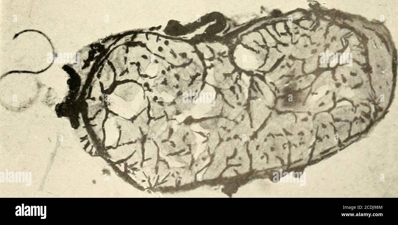. Anatomische Hefte . einfache SchlingeTuberositas tibialiszusammengesetzte Schlinge Fig. 11. Sagittalschnitt durch die äussere Haut, das Lig. Rotulae und das obere Debia eines neugeborenen Kindes. Vergröss. 1 : 25. Die Figur zeigt die oberflächlichen Schlingennetze und die tieferen Schlingen der Capiliaren an der Ansatzstelle der Sehne, ferner die Blutgefässe des oberen ENDES der Tibia und der äusseren Haut. Dorsal. Fig. 12. Querschnitt durch die Achillessehne eines neugeborenen Kindes. Vergröss. 1 ; 8. Die Figur zeigt die Blutgefässe an der Oberfläche im Bereich im Bereich im Bereich Foto Stock
