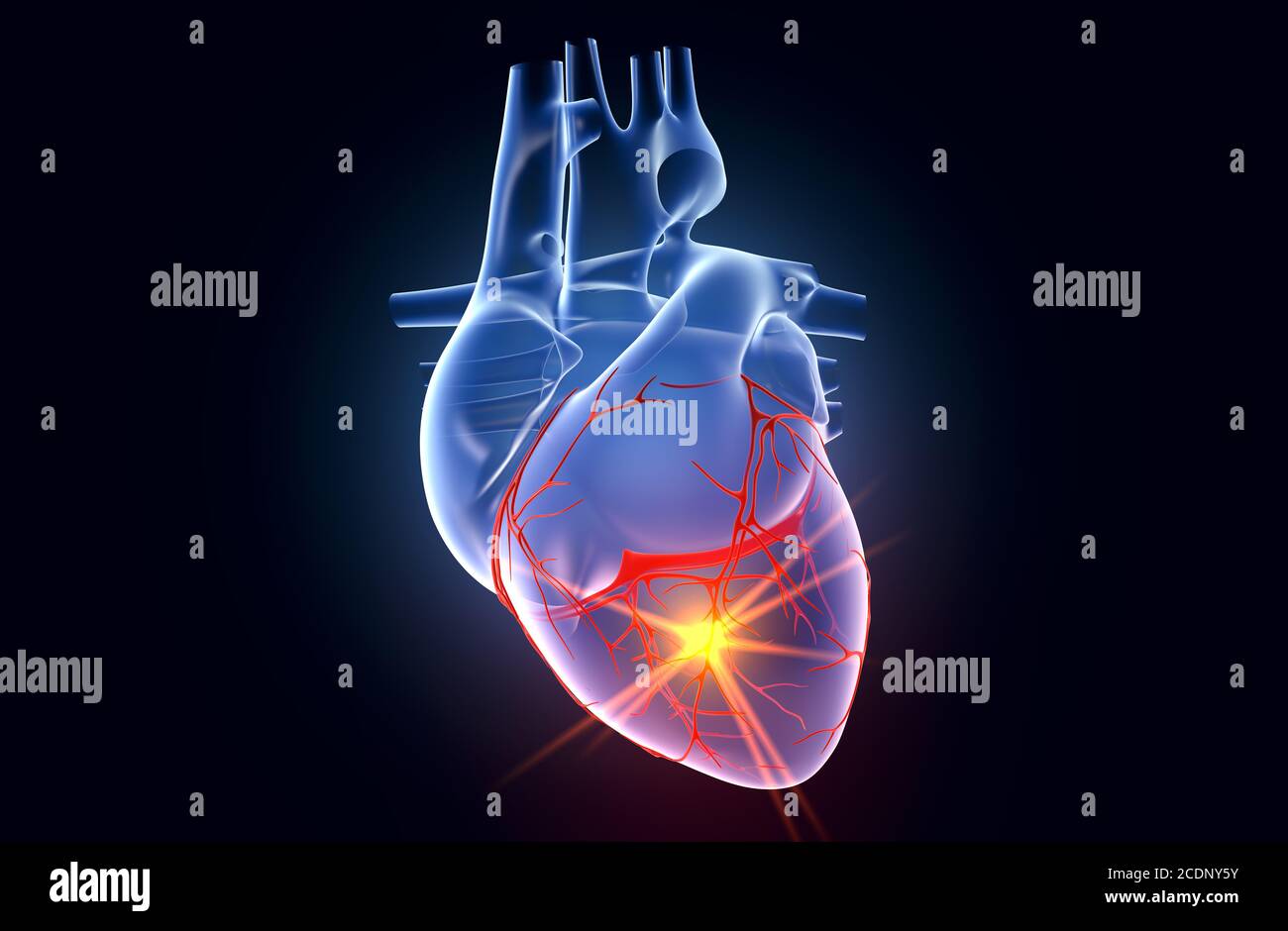 Cuore umano con arteria coronaria e forme d'onda ECG Foto Stock