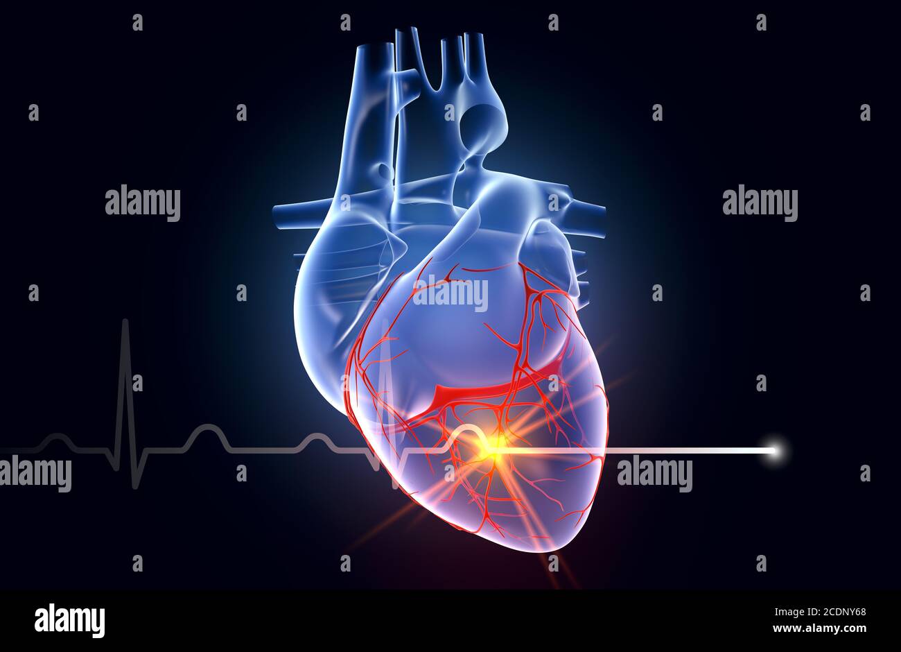Cuore umano con arteria coronaria e forme d'onda ECG Foto Stock