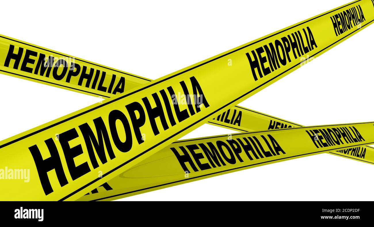 Nastri di avvertimento gialli con parole nere EMOFILIA (una condizione medica in cui la capacità del sangue di coagulo è gravemente ridotta). Isolato Foto Stock