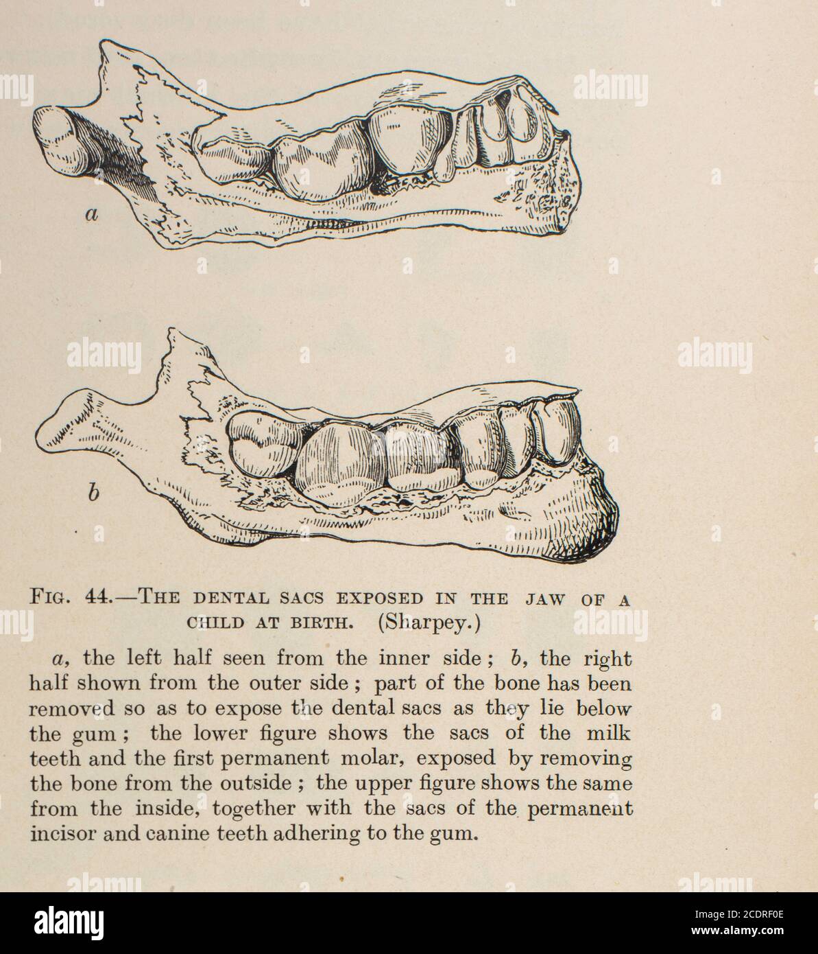 Quain's Elements of Anatomy col. III pubblicato nel 1896, un osso mandibolare del bambino. Foto Stock