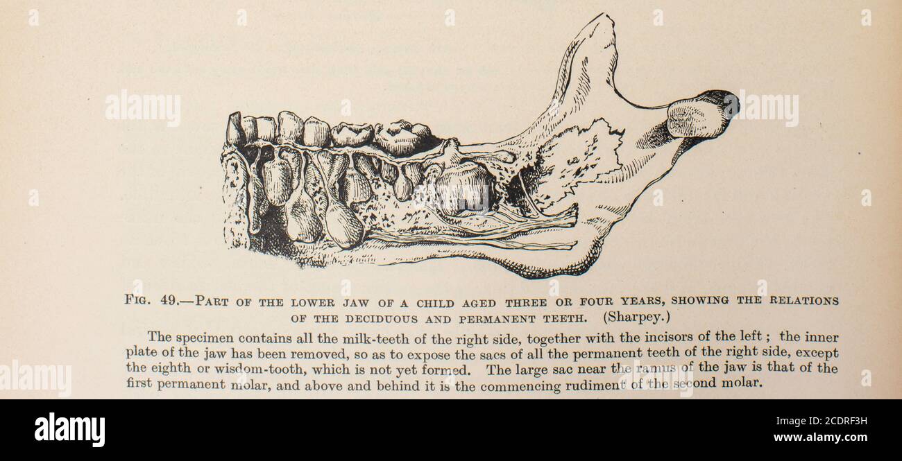 Quain's Elements of Anatomy col. III pubblicato nel 1896, un osso mandibolare del bambino. Foto Stock