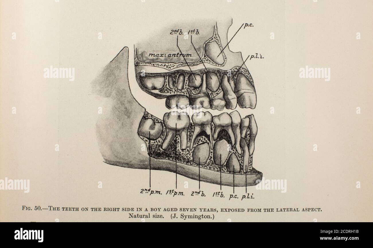 Dal Quain's Elements of Anatomy col. III pubblicato nel 1896, i denti dei bambini. Foto Stock