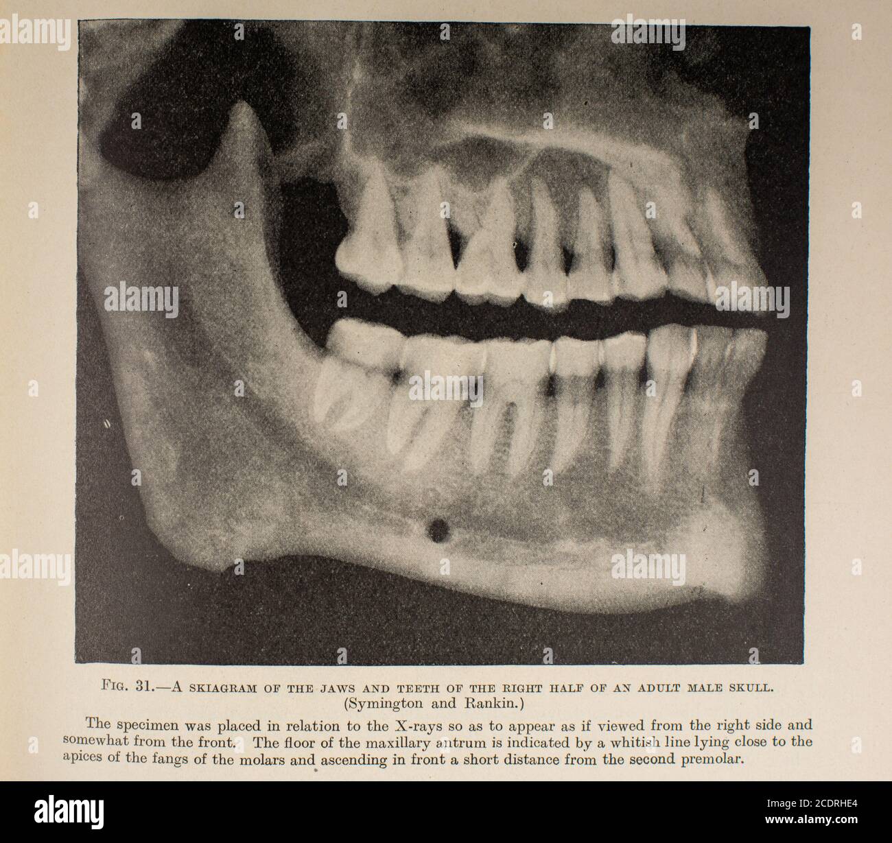 Quain's Elements of Anatomy col. III pubblicato nel 1896, dentali. Foto Stock